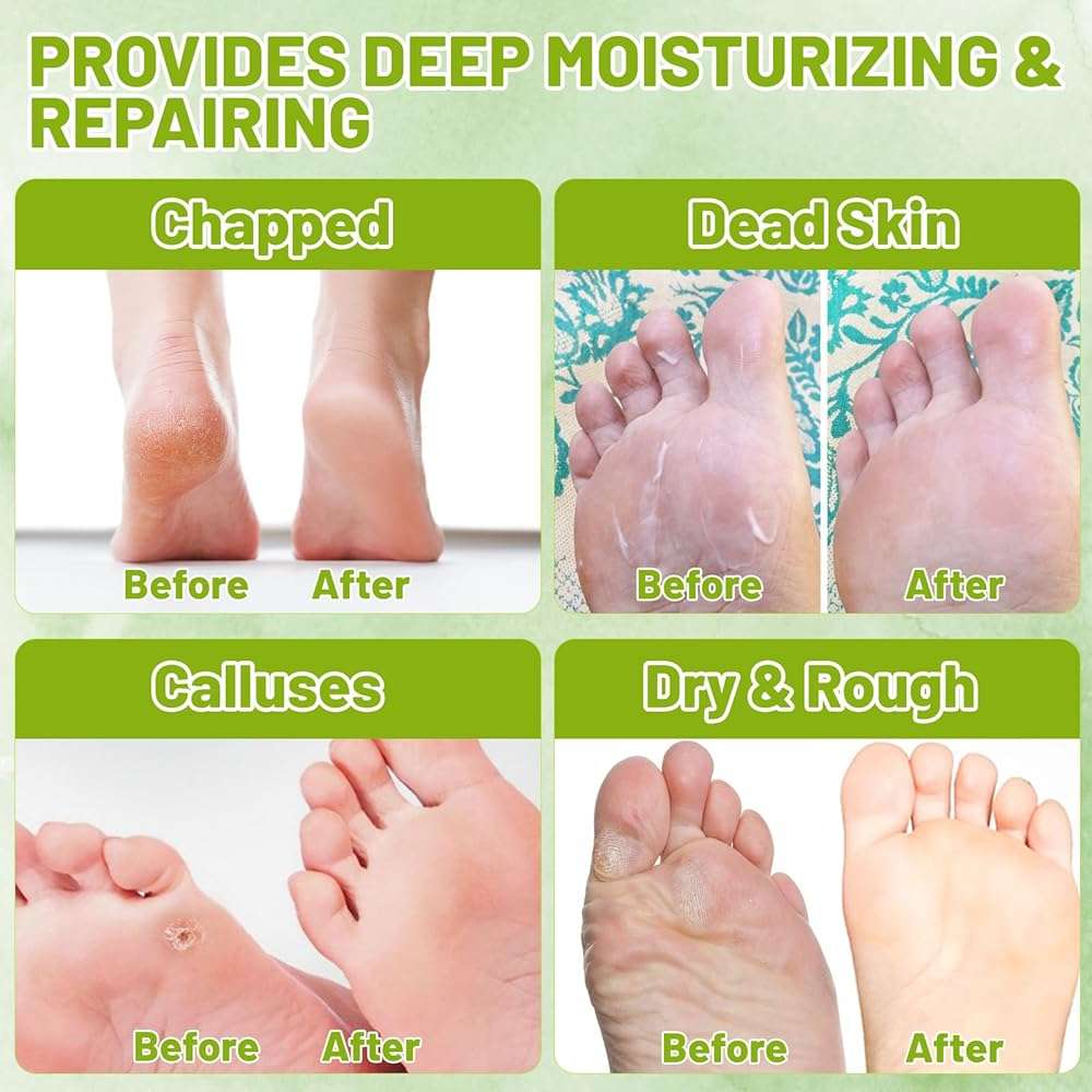 Mersenty 200 Pcs Disposable Foot Covers For Wax Therapy Plastic Waterproof Foot Mask Socks With Adhesive Stickers Home Pedicure Supplies Leak-Proof - Image 7