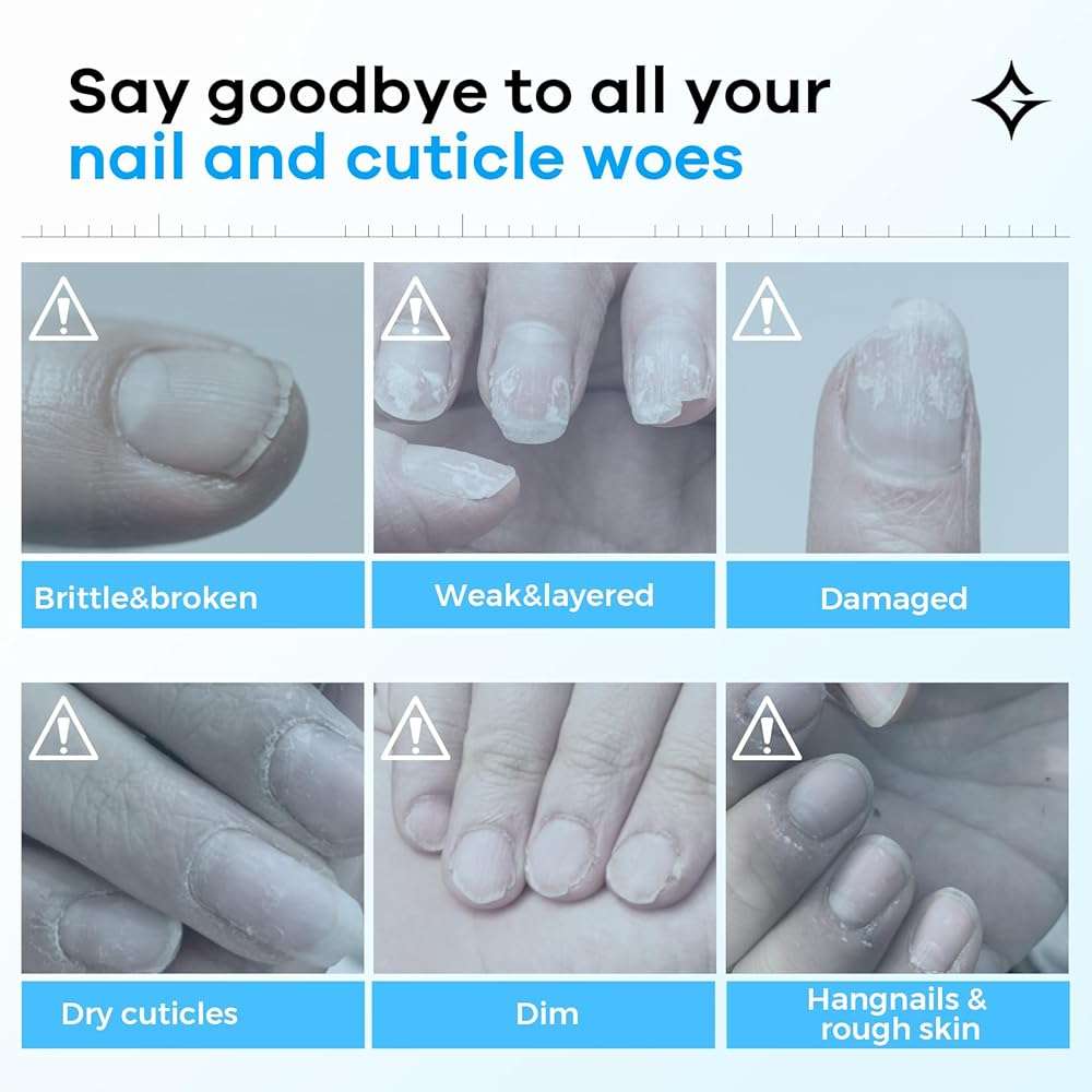 Glamonade Hard Nail Strengthening Cream: Nail strengthener and Cuticle Treatment To Repair Damaged Thin Nails and Dry Cracked Skin&Grow Nails, Plant-Based Scent, 1 oz,Essential Nail Care - Image 2