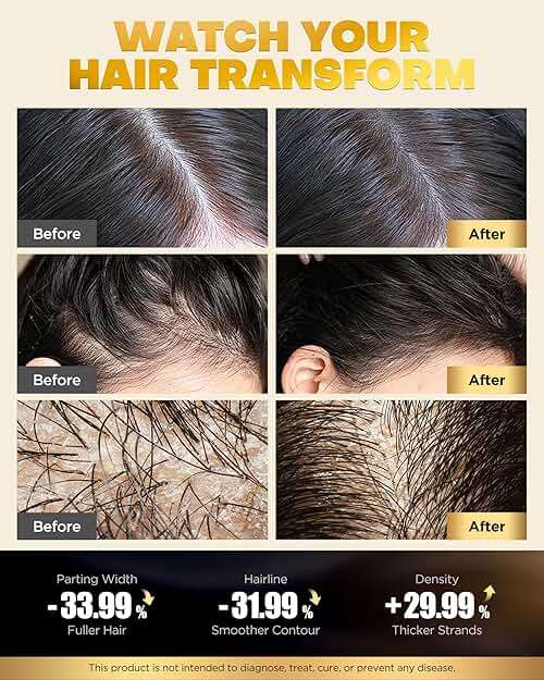 COOLKESI Tripeptide-Infused Biotin Hair Growth Shampoo and Conditioner Set, Onion Anti-Loss Volumizing Moisturizing Treatment for Soft Shine Hair, Dandruff Routine Shampoo for Men and Women, 2x16.9oz - Image 3