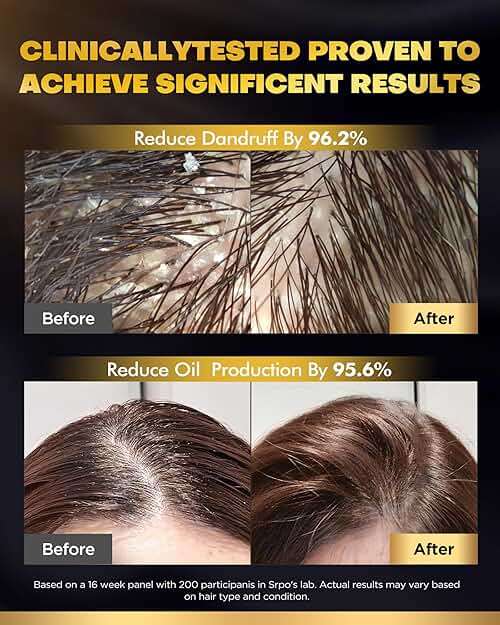 COOLKESI Tripeptide-Infused Biotin Hair Growth Shampoo and Conditioner Set, Onion Anti-Loss Volumizing Moisturizing Treatment for Soft Shine Hair, Dandruff Routine Shampoo for Men and Women, 2x16.9oz - Image 5