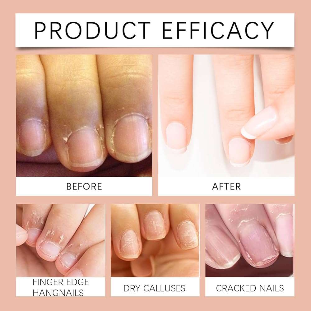 Peach Cuticle Exfoliating Balm – Nail & Hand Care Cream with Glycerin and Mineral Oil, Softens Cuticles, Locks in Moisture, Gentle Peach Scent - Image 4