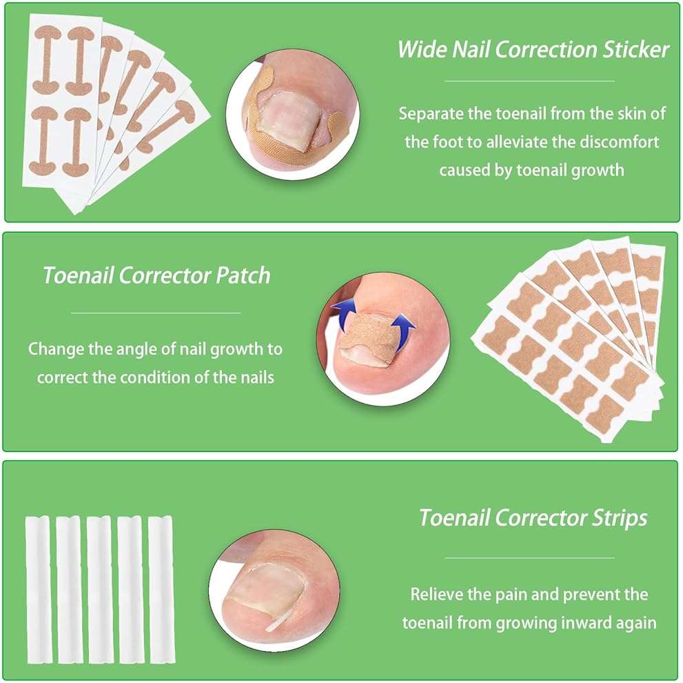 Ingrown Toenail Corrector Set, Professional Foot Care Kit for Ingrown Toenail Treatment & Removal, Toenail Straightener for Curved Pincer Thick Nails, Home Pedicure Tools for Men Women - Image 5