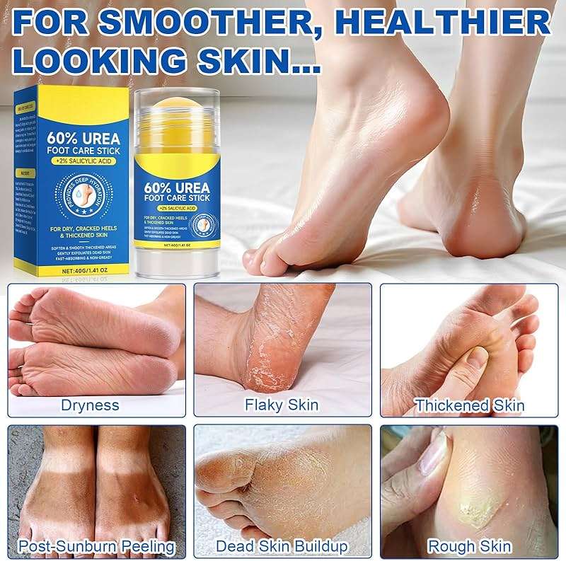 60% Urea Foot Cream Stick with 2% Salicylic Acid - Maximum Strength for Dry Cracked Heels & Calluses, Rapidly Softens Thick Skin, Exfoliates Dead Skin, Portable & Non-Greasy, 2-Day Visible Results - Image 8