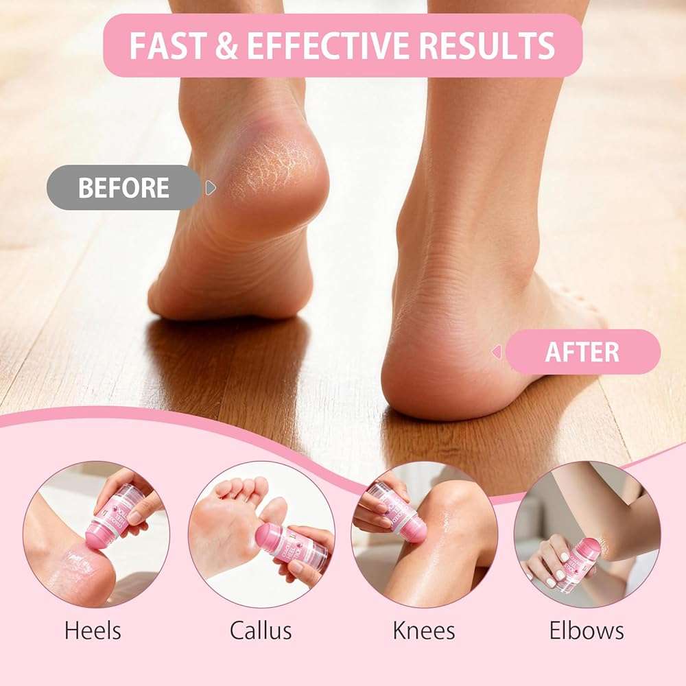 Silicone Moisturizing Socks with Foot Cream- 2 in 1 Gel Socks & Foot Cream for Dry Feet, Foot Care Moisturizing Socks for Dry Cracked Feet Women - Image 2