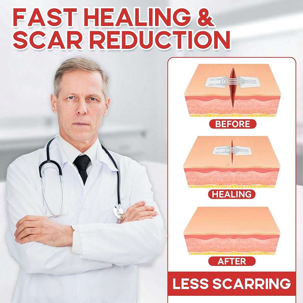 3 PCS Wound Closure Strips for Emergency Laceration & Wound Repair - Zipstitch Sutures - Painless Alternative to Stitches - Butterfly Bandages for Hiking, Camping, Survival & First Aid Kit Essential - Image 5
