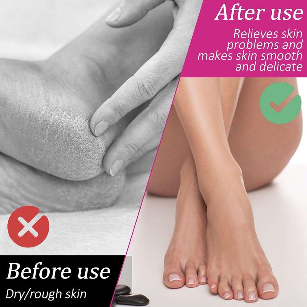 3 Pairs Moisturizing Socks Overnight for Dry Feet, Lotion Socks, Spa Cotton Moisture Enhancing Cosmetic Socks for Cracked Heel Repair for Women and Men - Image 4
