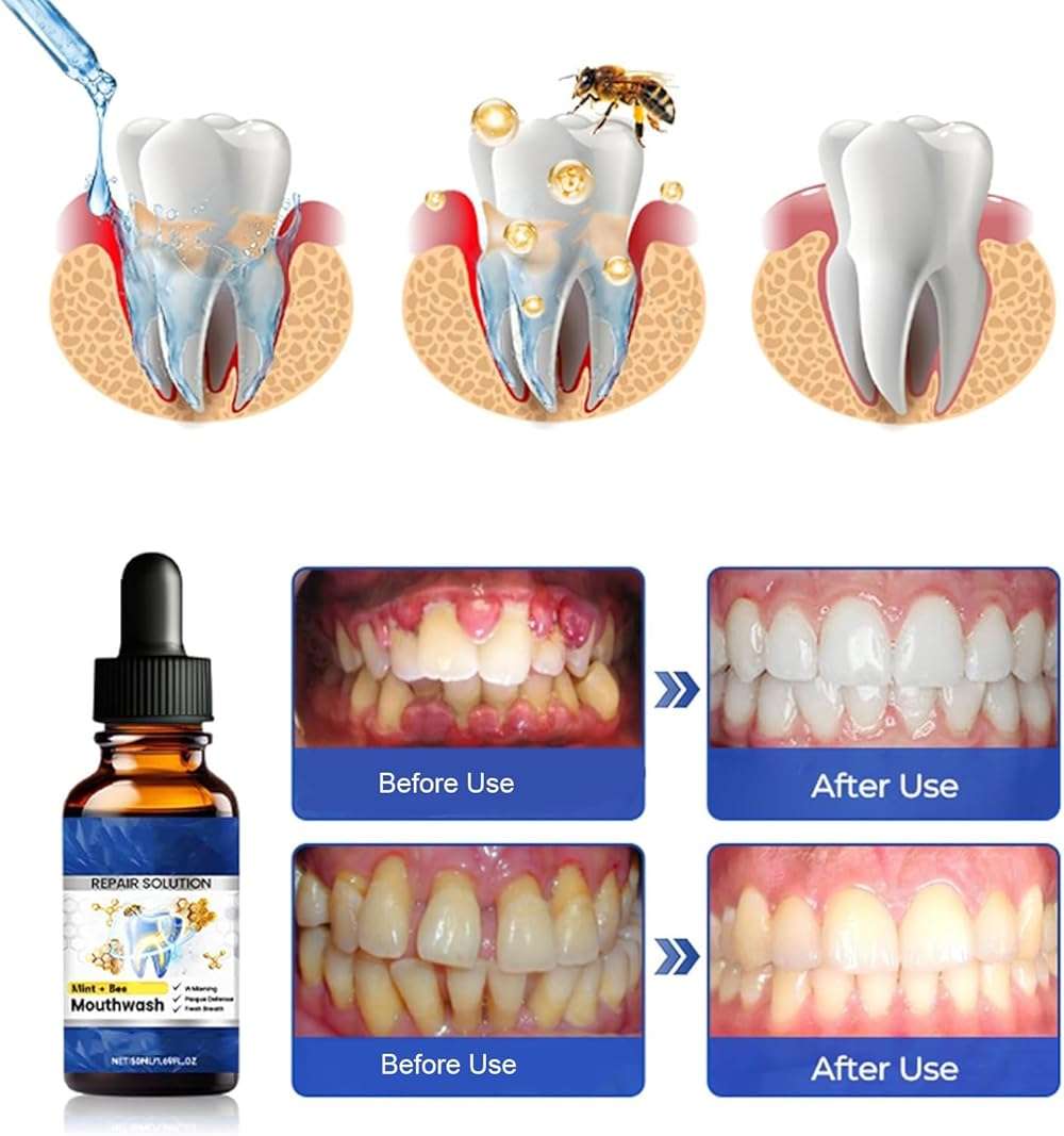 2PCS Beerakt Oral Repair Solution, Mint Flavored Oral Mouthwash，Effectively Improves Oral Hygiene & Long-Lasting Fresh Breath，Daily Oral Care Solution - Image 4