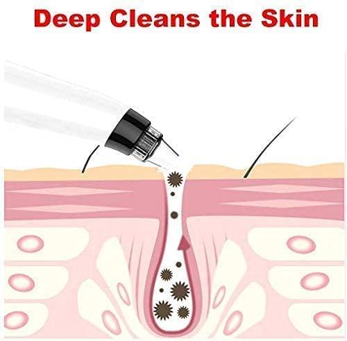 JPNK Blackhead Remover Tool Comedones Extractor Acne Removal Kit for Blemish, Whitehead Popping, 6 Pcs Zit Removing for Nose Face Tools with a Leather Bag - Image 5