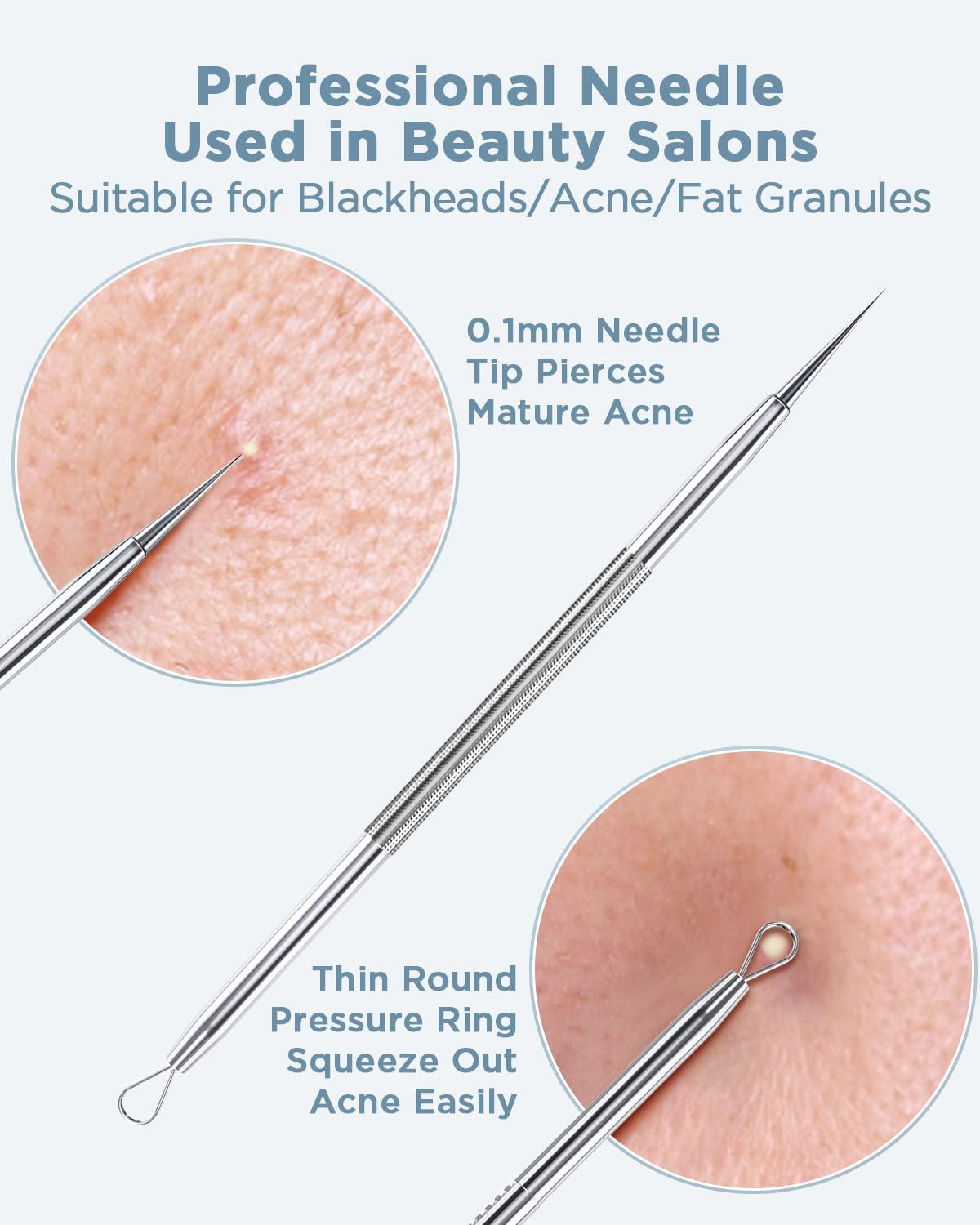 BESTOPE Blackhead Remover Blackhead Removal Pimple Comedone Extractor Tool - Treatment for Blemish Whitehead Popping Zit Removing with Metal Case (Silver) - Image 4