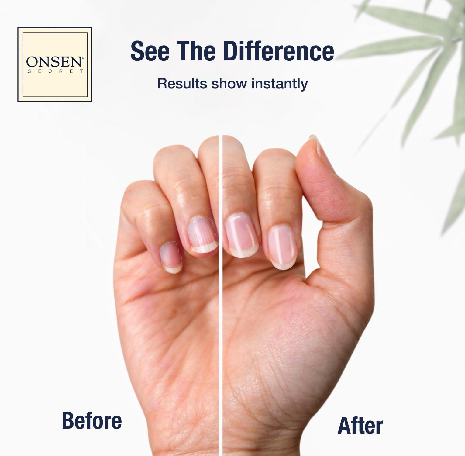 Onsen Nail & Cuticle Cream Treatment w/Japanese Tsubaki, Jojoba & Lavender Oil, Shea Butter – Strengthens Nails, Softens Cuticles - Daily Repair Care (1 Count/15 ml) - Image 2