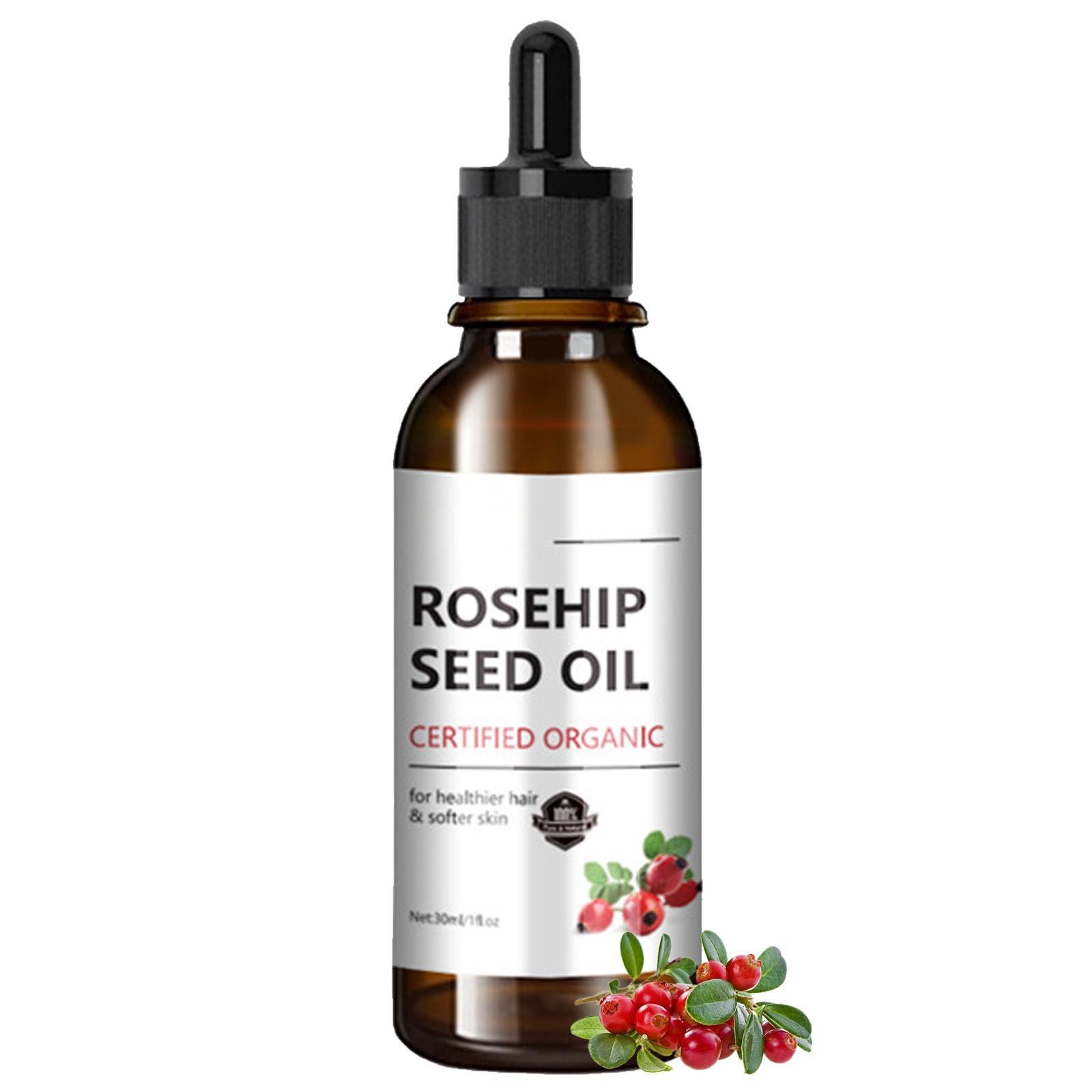 ARCHIDATE Rosehip Seed Oil for Face, 100% Organic Cold Pressed Rosehip Oil, Rose Hip Seed Oil Moisturizer Skin Face, Hair, Nails and Body, Anti-Aging, Smooth Fine Line & Wrinkle, 30ml