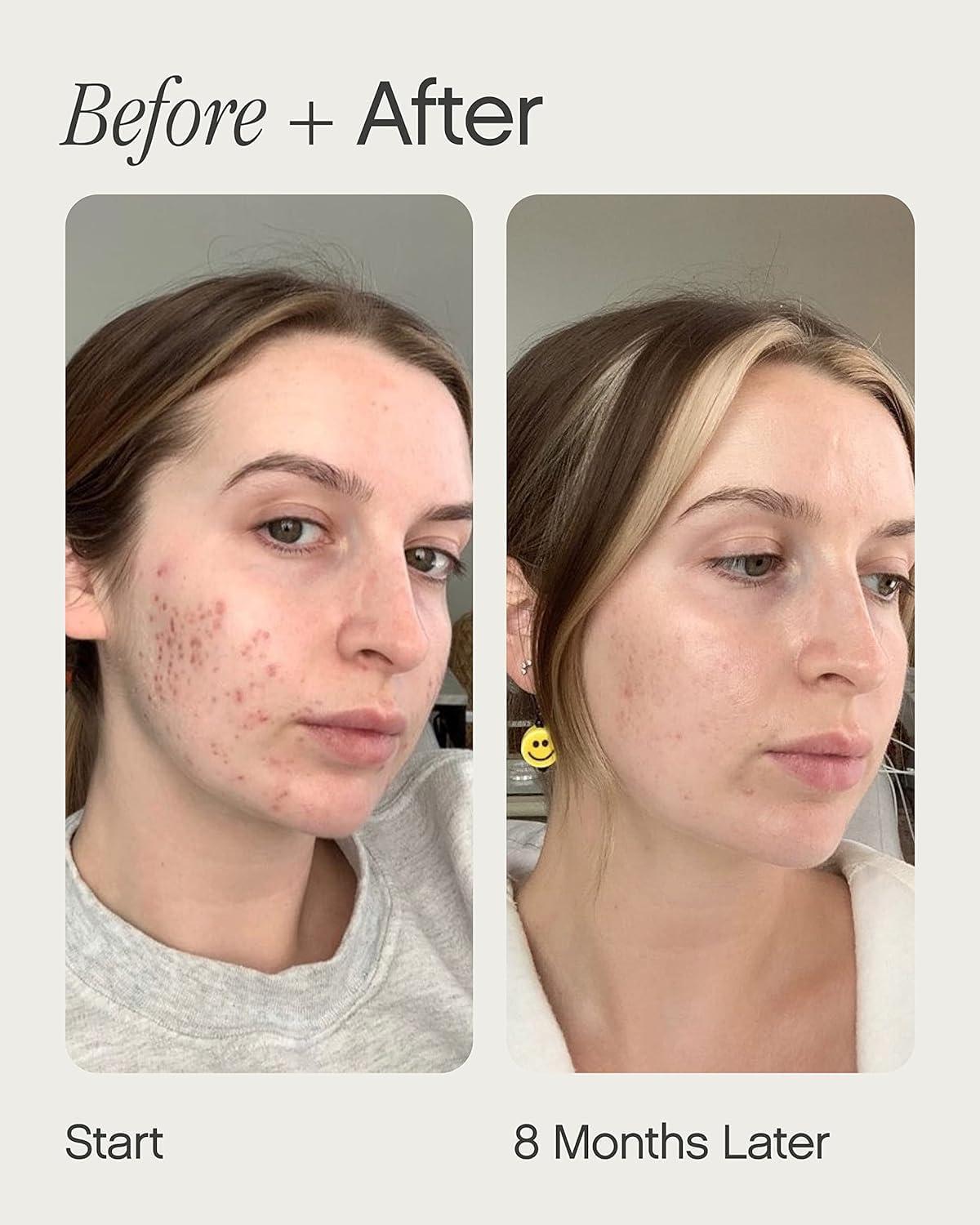 Topicals Faded Brightening and Clearing Serum | Reduces Discoloration Post-Blemish Marks Scars Spots Contains Kojic Acid Niacinamide Dermatologist-tested Vegan Cruelty-Free Fl Oz - Image 4