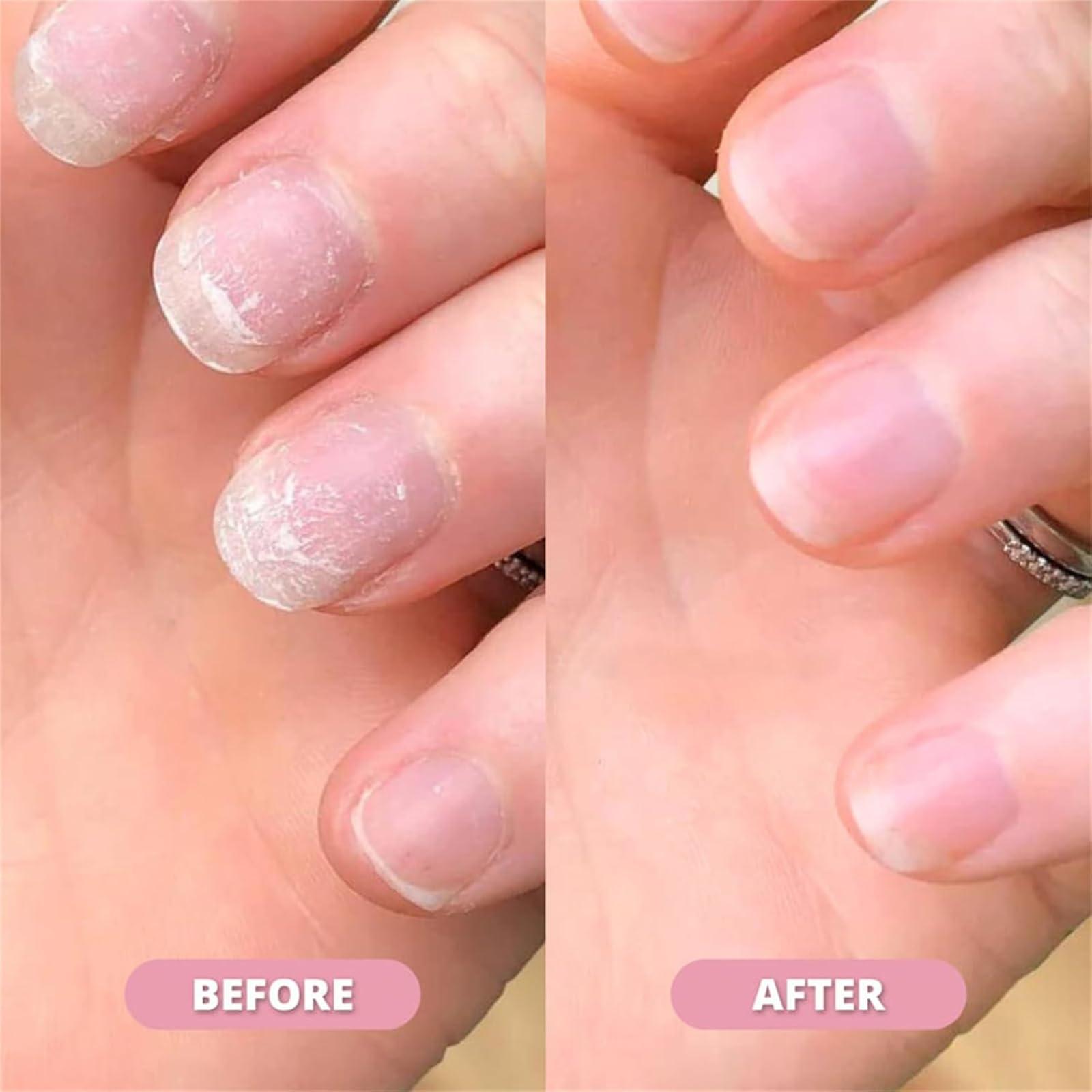 Nailz Nail 𝐆𝐫𝐨𝐰𝐭𝐡 Pen, Anperio 𝐒𝐭𝐞𝐦 𝐂𝐞𝐥𝐥 Nail 𝐆𝐫𝐨𝐰𝐭𝐡 Pen, Cuticle Oil for Nail Growth and Strength (3pcs, one size) - Image 4