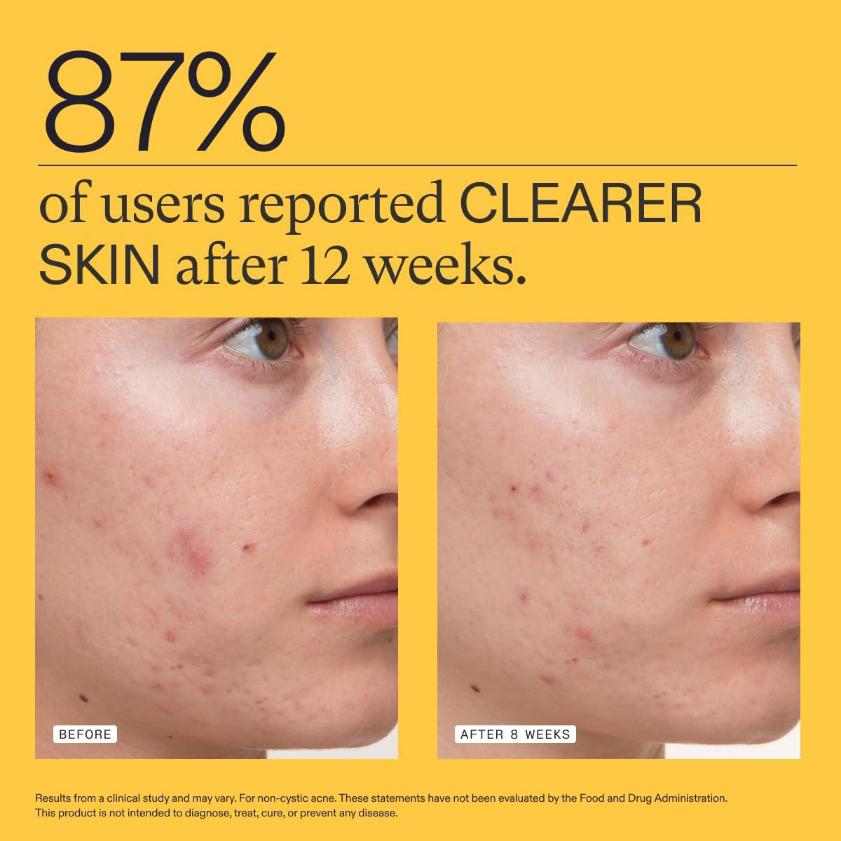 Nutrafol Clear Skin Acne Supplement for Women, Clinically Tested for Clearer, Smoother Skin, Physician-Formulated, Vegan - Image 4