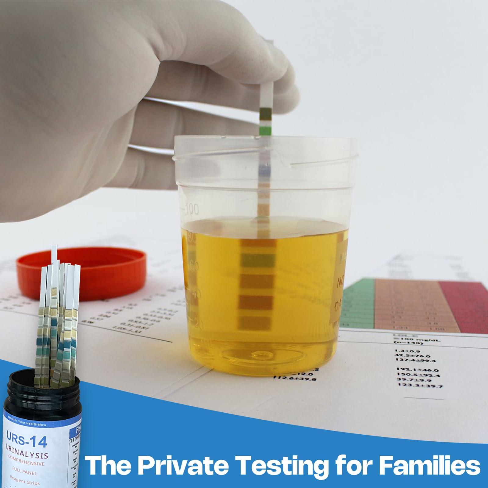 14-Panels Urinalysis Test Strips | 120 Strips, Urinalysis and Detection for Kidney, Liver, UTI, Ketosis - SG, PRO, BIL, KET, CRT +9 More - Image 5