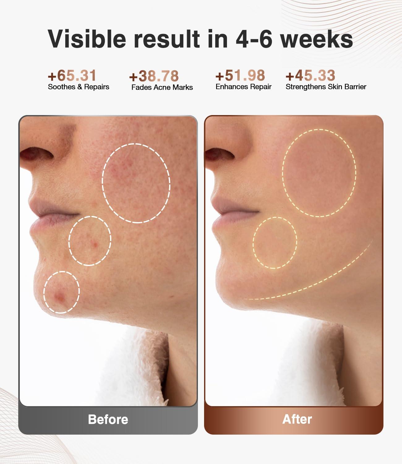 JOVS Red Light Therapy for Face, Wireless LED Light Therapy Beauty Device for Face, 4 Modes and Portable Skin Care Tools for Home Use - Image 4