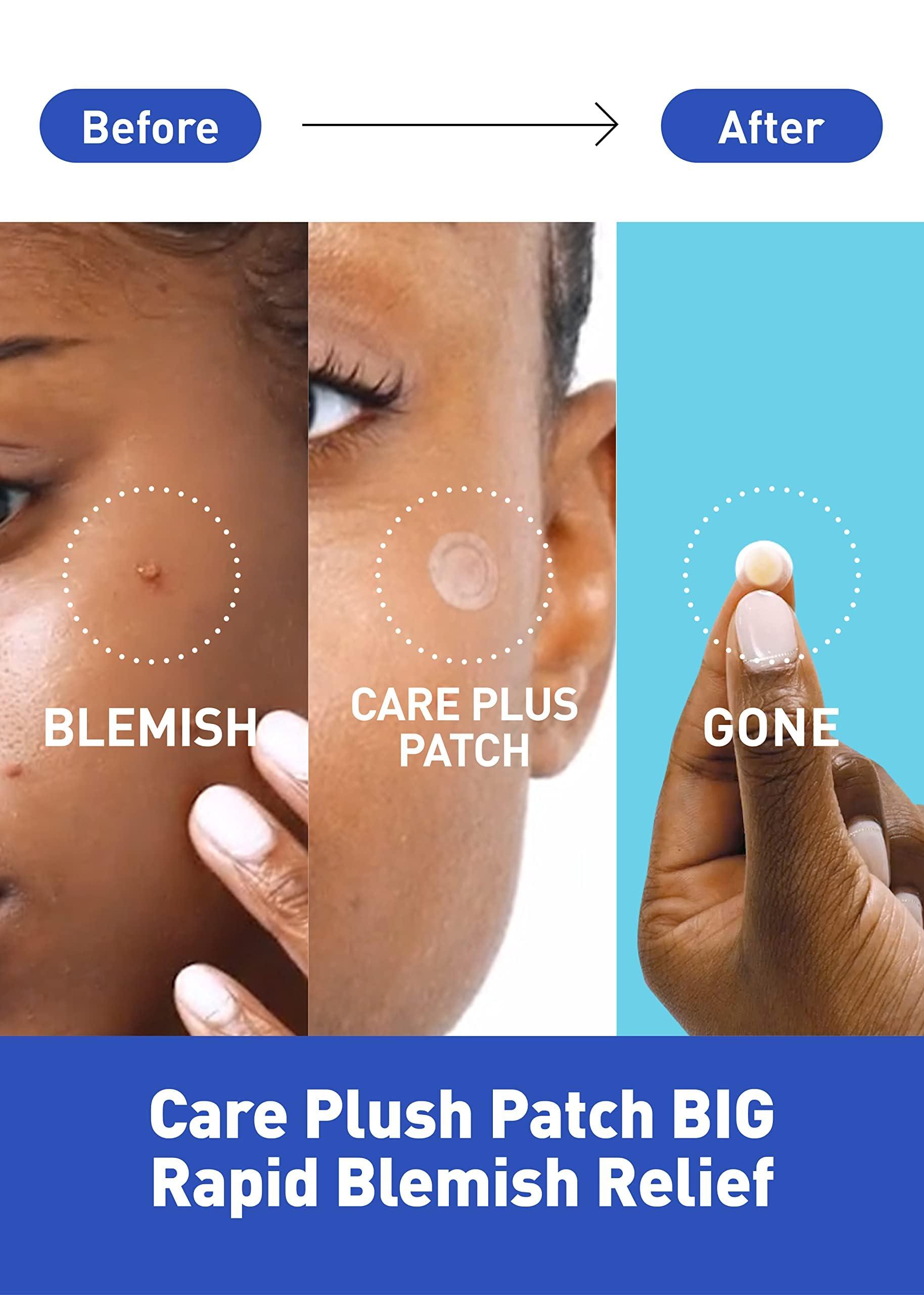 OLIVE YOUNG Care Plus Spot Patch | Hydrocolloid Acne Korean Spot Patch to Cover Zits, Pimples and Blemishes, for Troubled Skin and Face (Hydrocolloid, 102 Count (Pack of 1)) - Image 3