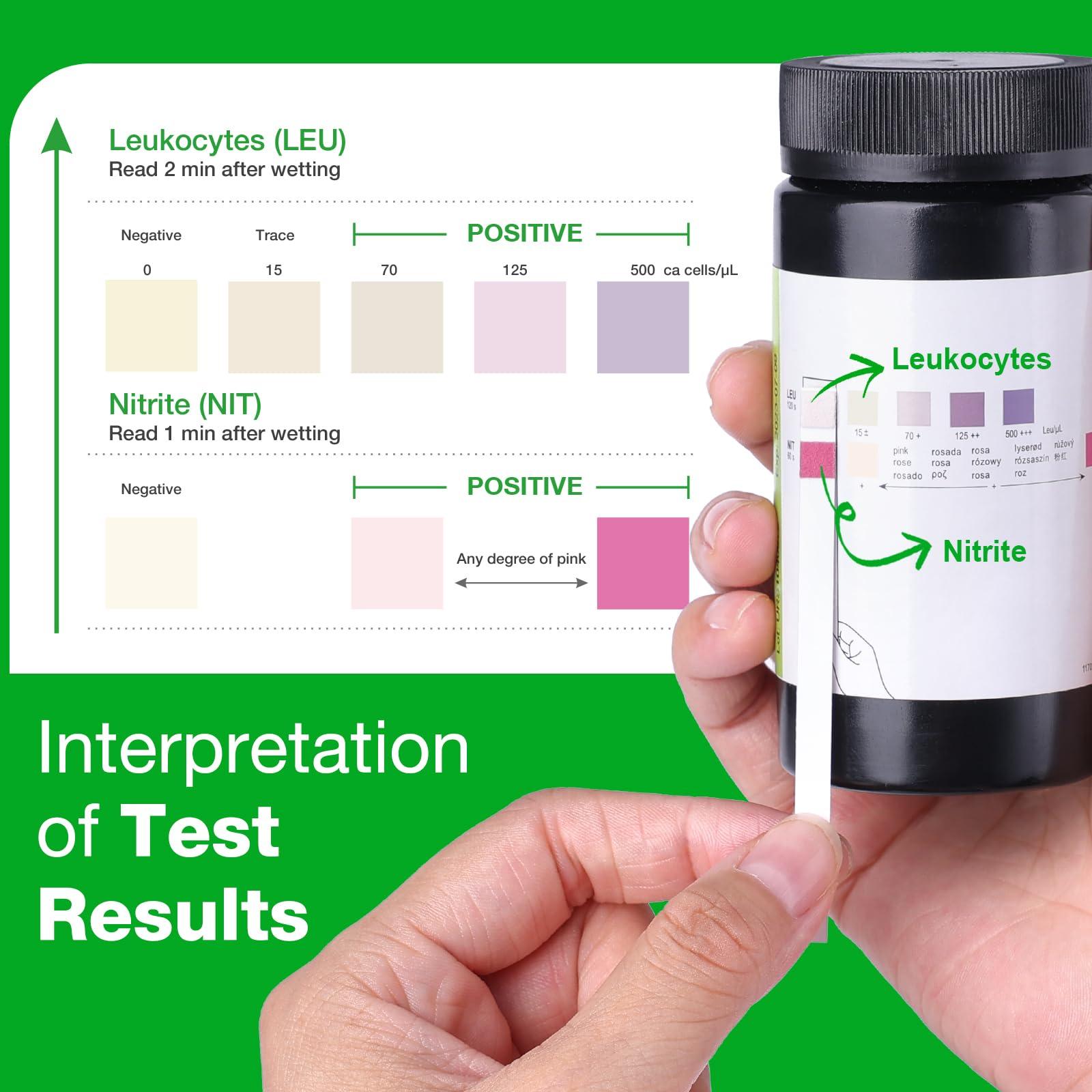 Easy@Home 50ct UTI Test Kit Bladder Infection Test Strips, FSA or HSA Eligible, at Home UTI Urinalysis Test Strips for Women Urinary Tract Health, Highly Accurate UTI Testing (UTI-50Pcs) - Image 6