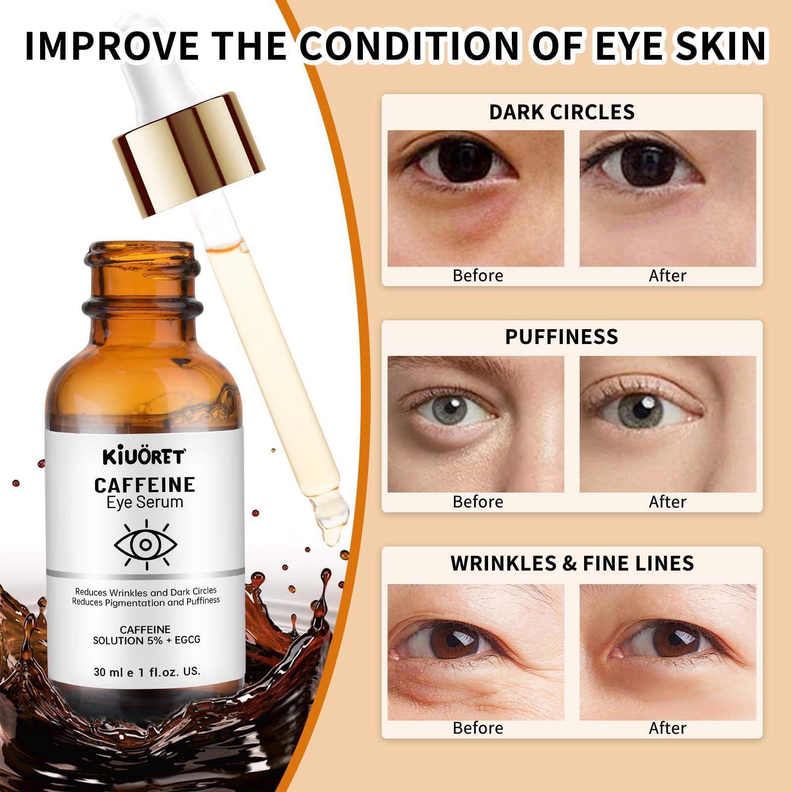 Caffeine Eye Serum with EGCG, 5% Caffeine Solution for Eyes Reduces Pigmentation and Puffiness, Under Eye Serum for Dark Circles, Wrinkles and Fine Lines for All Skin Types, 1 OZ - Image 4