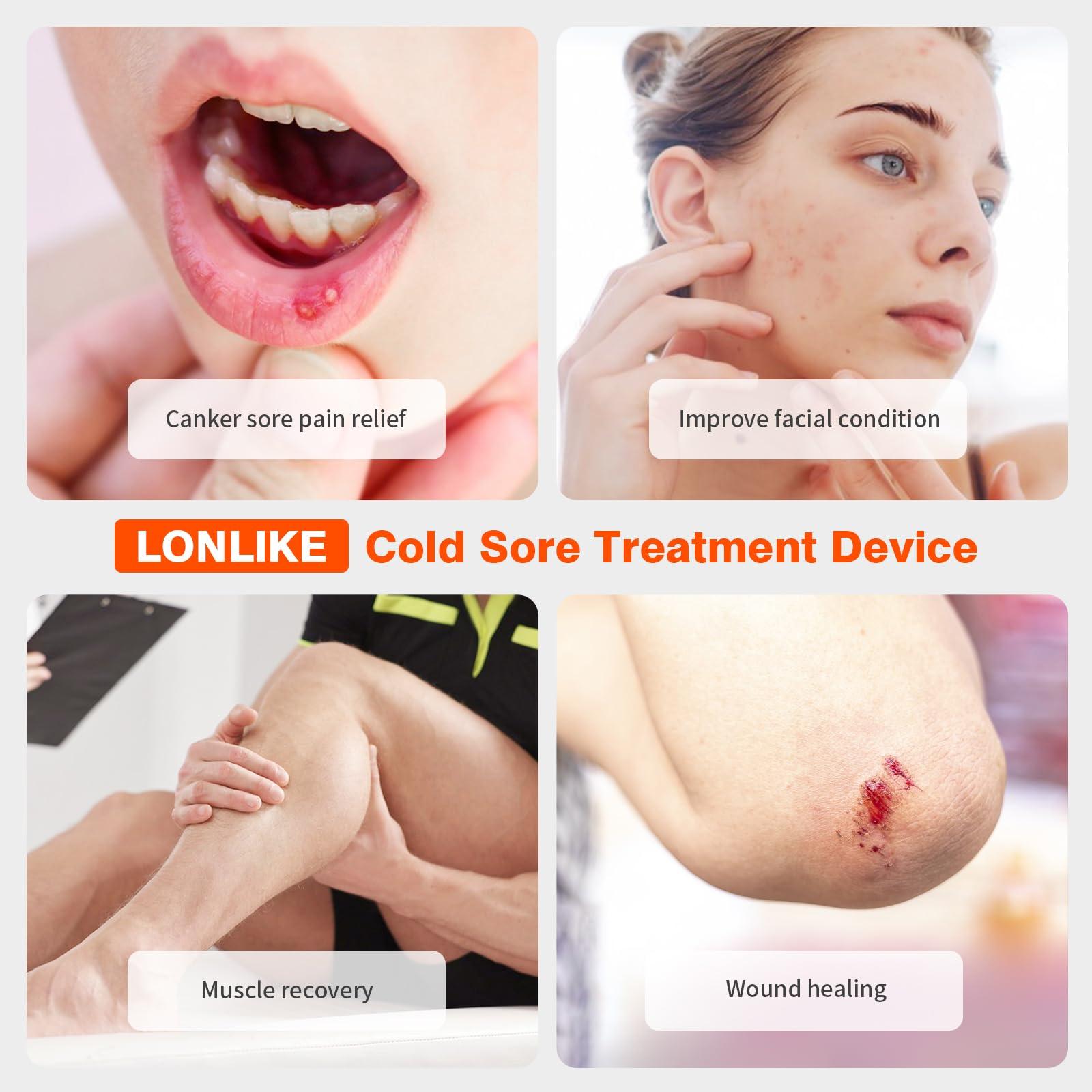 Red Light Cold Sore, Cold Sore Treatment Device, Red Light Therapy for Cold Sore Lips Nose Face Hand, Target Skin Small Area - Image 3