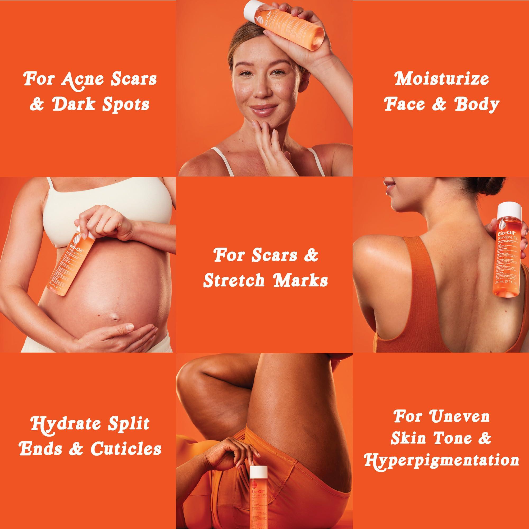 Bio-Oil Skincare Body Oil Serum, Face and Body Moisturizer with Vitamin E & A, for Scars, Stretch Marks, Sensitive Skin, All Skin Types, Dermatologist Recommended, Non-Comedogenic, 6.7 Oz - Image 5