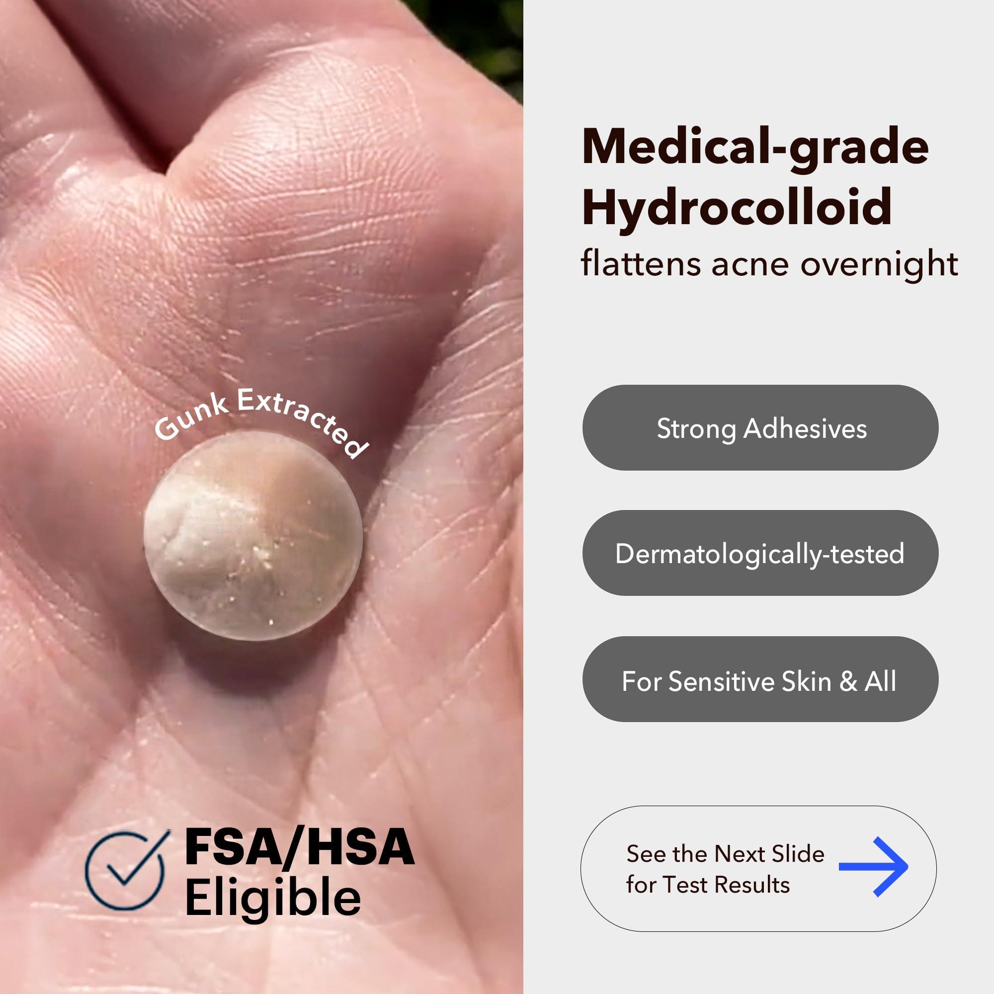 AVARELLE Acne Cover Patches, FSA HSA Eligible Hydrocolloid Pimple Patches for Face with Tea Tree Oil, Korean Skincare Zit Patches for Face | FSA HSA Store Eligible Items | Vegan, Cruelty-free - Image 2