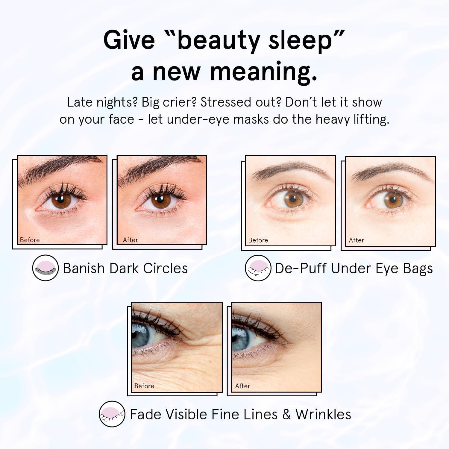 grace & stella Under Eye Patches for Puffy Eyes and Dark Circles (Retinol, 24 Pairs) Restoring Gel Under Eye Masks with Hyaluronic Acid - Vegan Cruelty-Free Skincare Birthday Gifts for Women - Image 4
