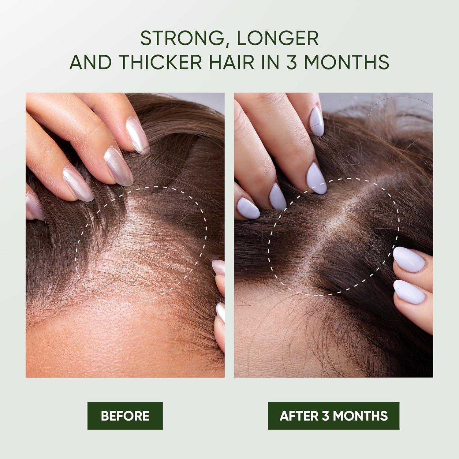 Svvimer Rosemary Hair Growth Shampoo - Thickening Shampoo with Biotin Tea Tree Oil Mint for Hair Loss and Thinning Hair - for Women and Men 11.8 Fl Oz (Pack of 1) - Image 2
