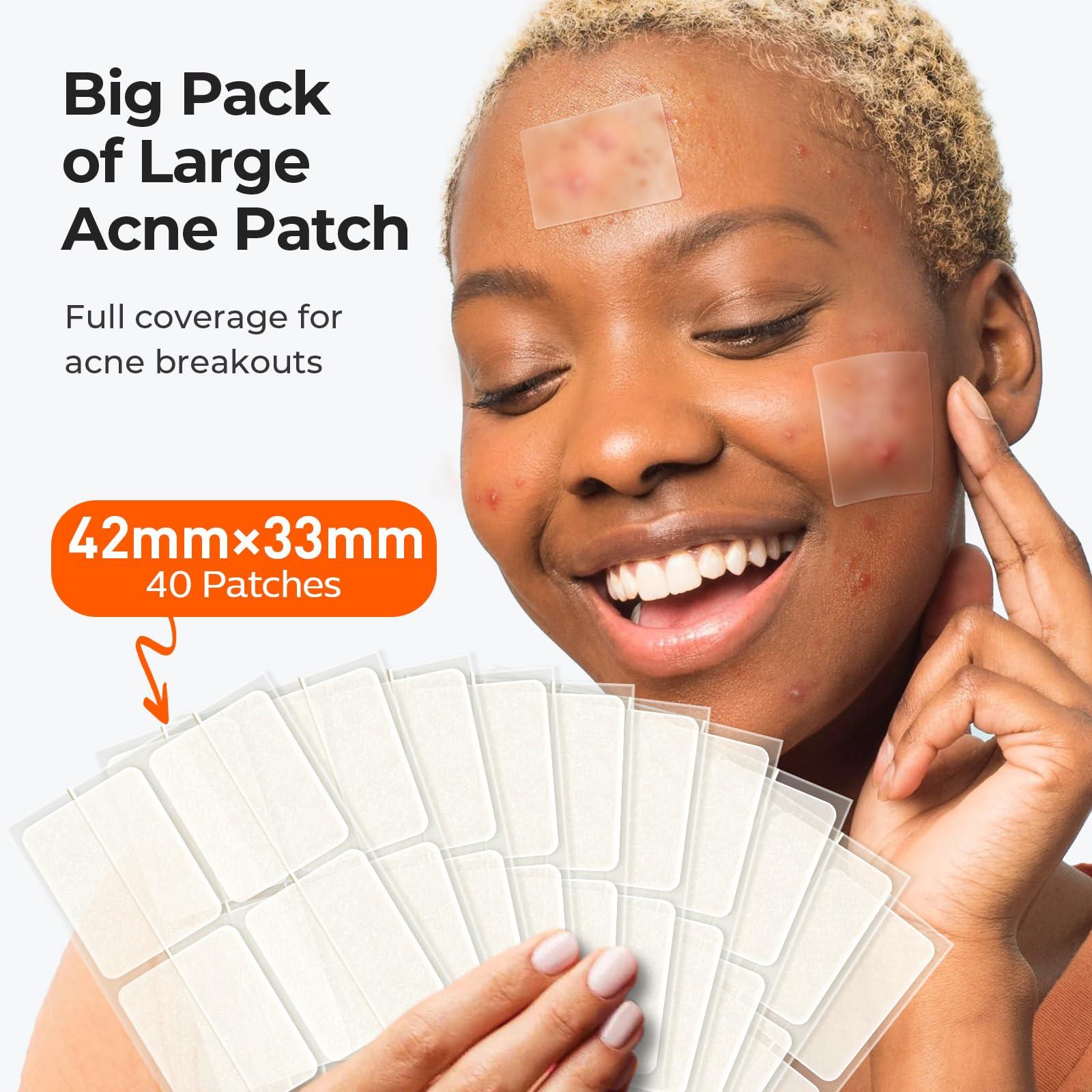 TKTK Large Pimple Patches (5 Sizes, 92 Patches), Hydrocolloid Acne Patches, XL Zit Patches for Face, Forehead, Chin, Nose, Body, Back, Chest, Rectangular, Square, and Dot Hydrocolloid Bandages - Image 2