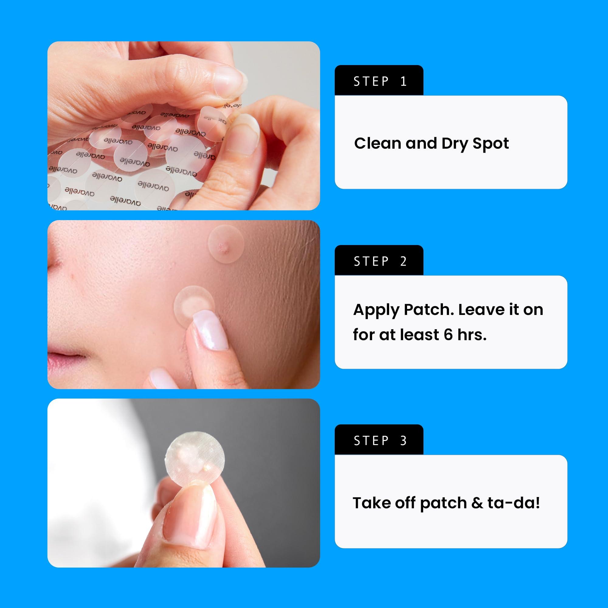 AVARELLE Acne Cover Patches, FSA HSA Eligible Hydrocolloid Pimple Patches for Face with Tea Tree Oil, Korean Skincare Zit Patches for Face | FSA HSA Store Eligible Items | Vegan, Cruelty-free - Image 7
