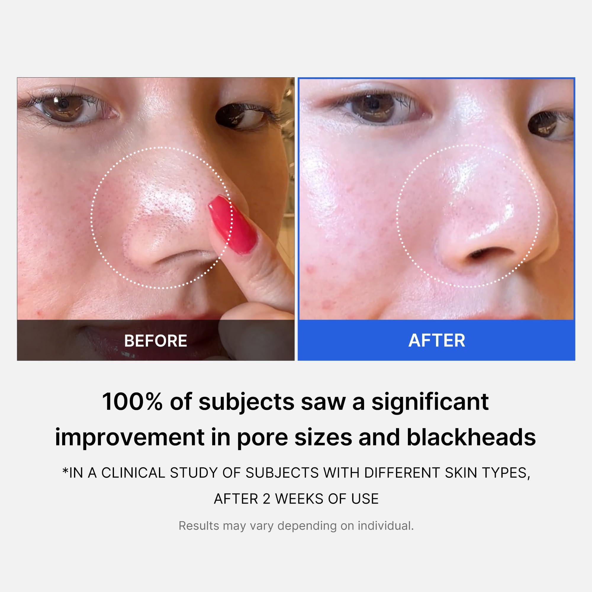 Medicube Zero Pore Pads 2.0, Dual-Textured Facial Toner Pads for Exfoliation and Pore Care with 4.5% AHA Lactic Acid & 0.45% BHA Salicylic Acid, Ideal for All Skin Types, Korean Skin Care (70 units) - Image 4