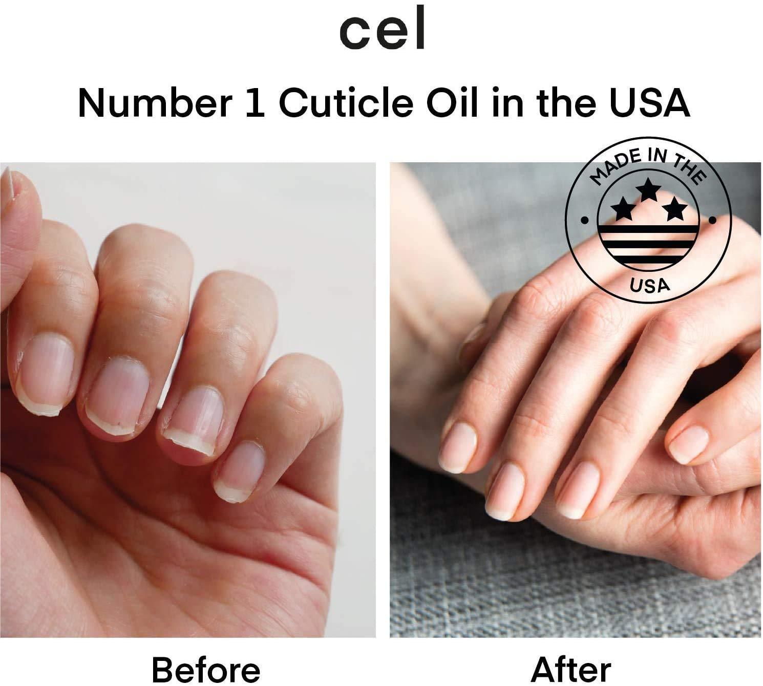cel MD Cuticle Oil Pen Nail Strengthener Repair Serum – Nail Repair For Damaged Nails – Helps Repair & Nourish Cracked Nails and Rigid Dry Cuticles - Set of 2 - Image 3