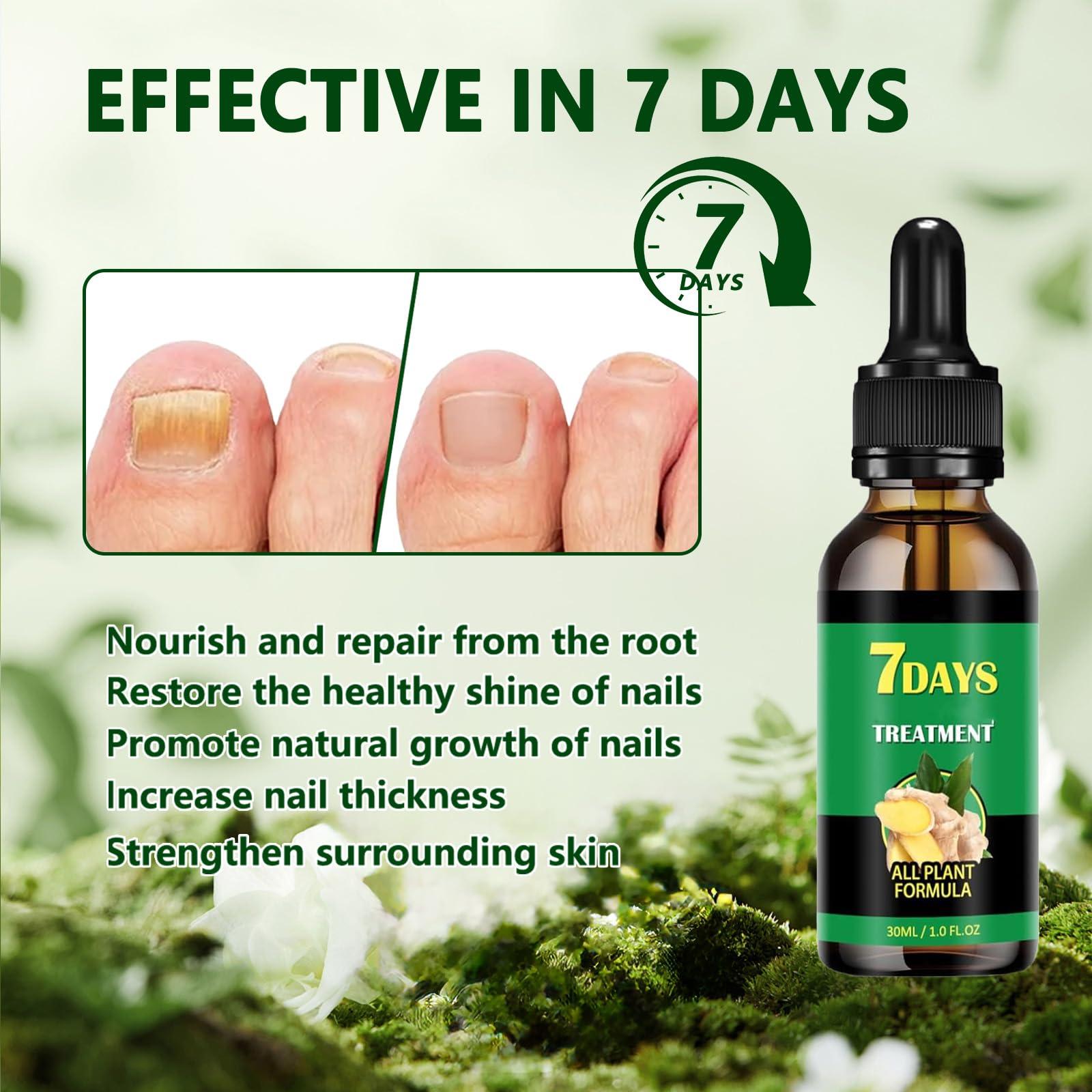 2PCS Ginger Nail Treatment – Nail Growth Serum & Cuticle Care Oil, 7-Day Nail Repair & Strengthener, Nourishing Nail Nutrient Oil for Healthier, Stronger Nails 2 Fl Oz (Pack of 2) - Image 4