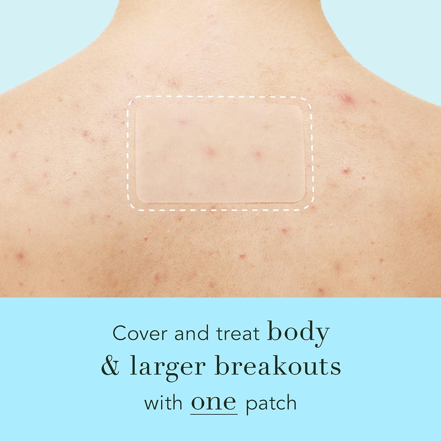 Rael Pimple Patches, Miracle XL Spot Control Cover - Hydrocolloid Acne Patch for Face, Zits & Blemish, Back and Body, Korean Skin Care, Vegan, Cruelty Free (6 Count) - Image 5