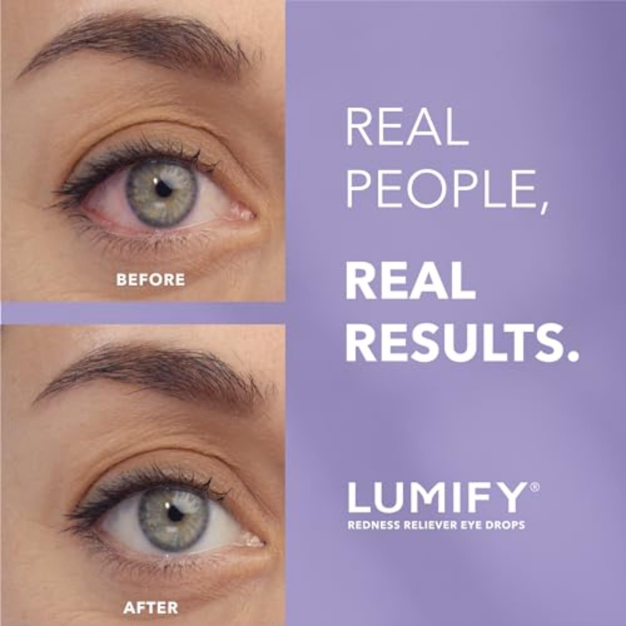 LUMIFY Eye Drops for Red Eyes, Redness Reliever for Brighter Looking Eyes, Works in 1 Minute & Lasts Up to 8 Hours, Eye Drops, 0.08 Fl Oz (2.5 mL) - Image 3