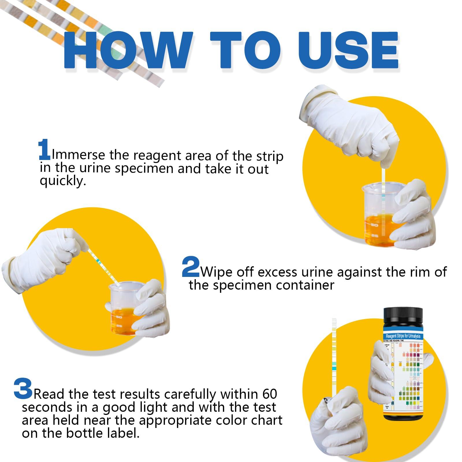 14-Panels Urinalysis Test Strips | 120 Strips, Urinalysis and Detection for Kidney, Liver, UTI, Ketosis - SG, PRO, BIL, KET, CRT +9 More - Image 3
