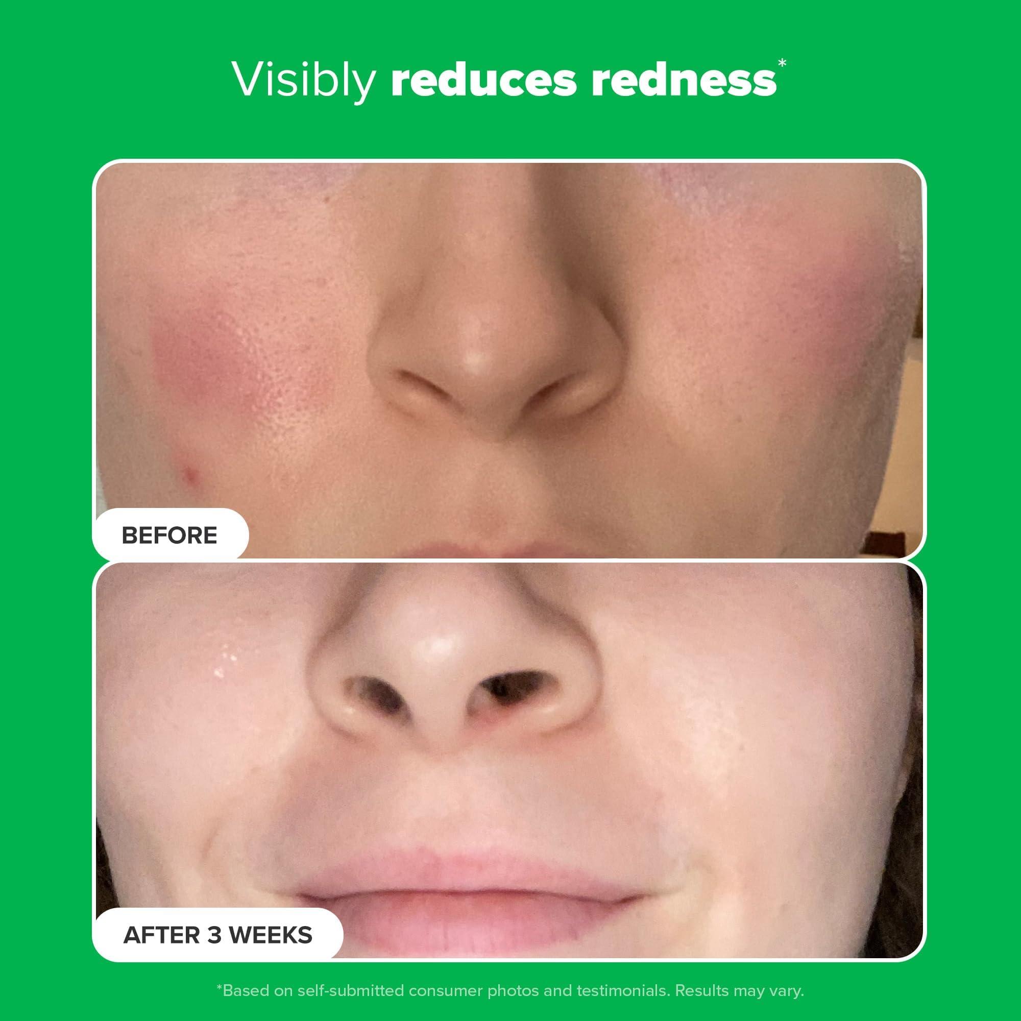 Paula's Choice BOOST 10% Azelaic Acid Booster Cream Gel, Licorice Extract & Salicylic Acid, Oil-Free Skin Brightening Serum - Image 6