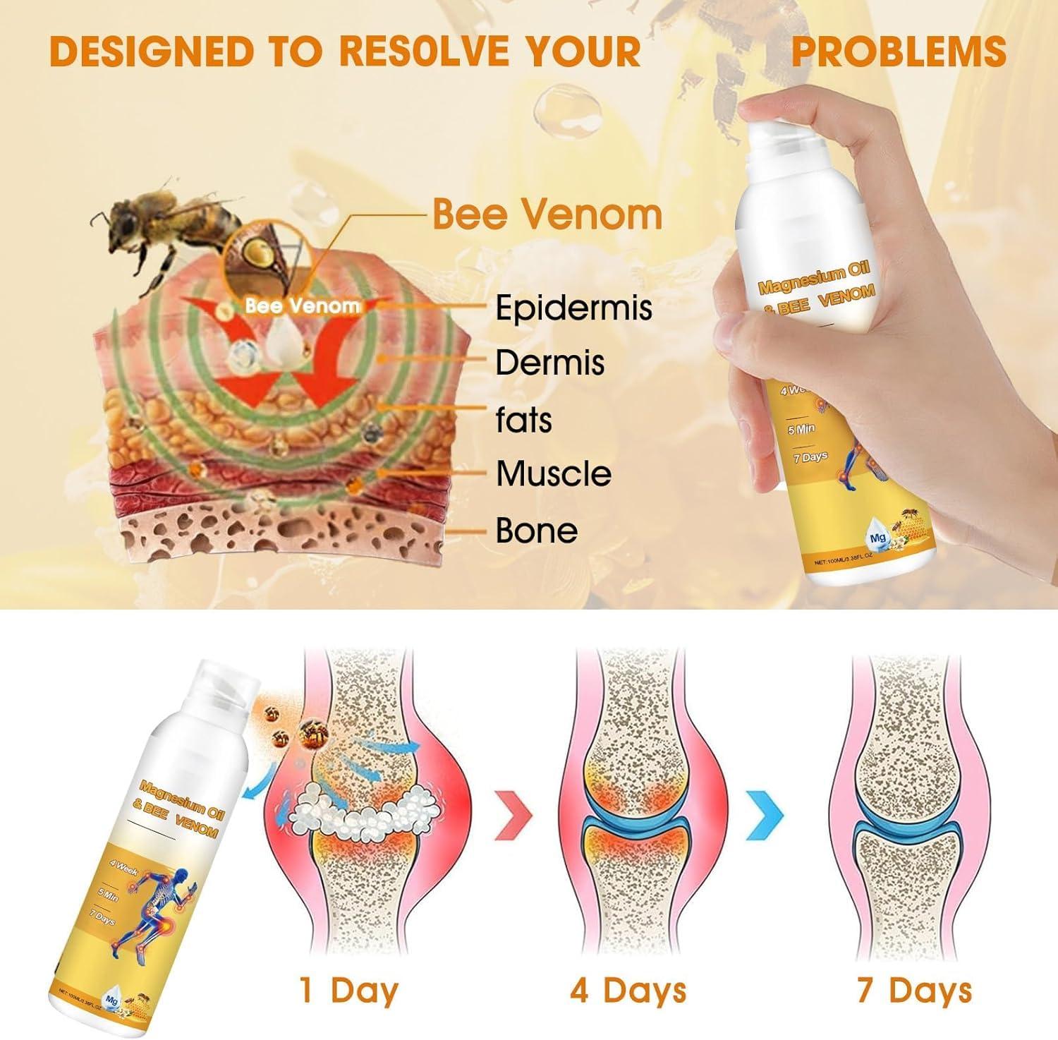 Magnesium Joint Spray, Professional Magnesium Joint Oil,Magnesium Oil & Bee Venom Joint Spray for Back, Knee, Hands, Neck （1 PCS,100ml） - Image 2