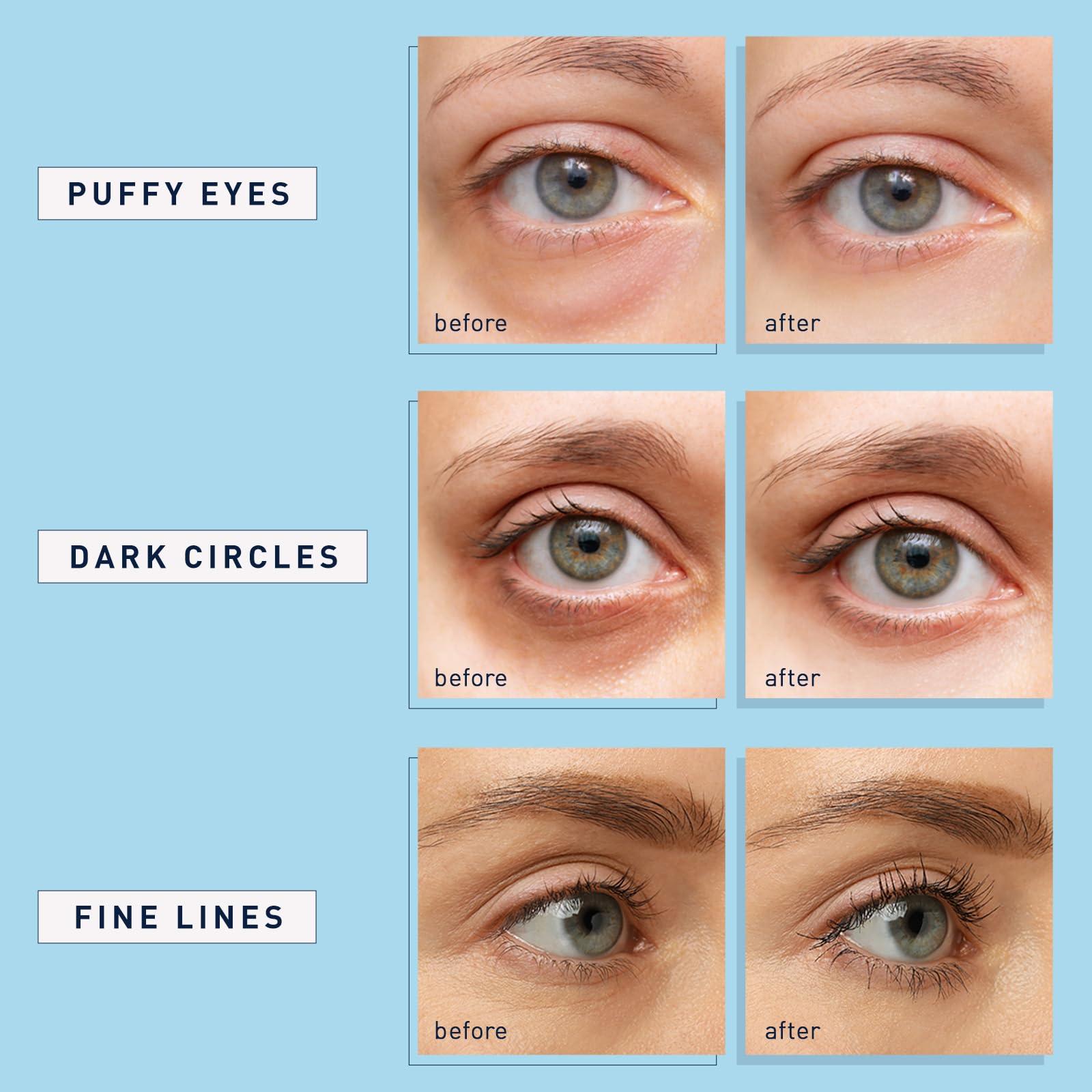 Enaskin Naturals Under Eye Patches for Dark Circles: 30 Pairs Retinol Collagen Eye Gels Mask - Reduce Wrinkles Puffy & Bags - Skin Treatment Pads - Anti Aging Moisturizer For Women (Blue) - Image 4