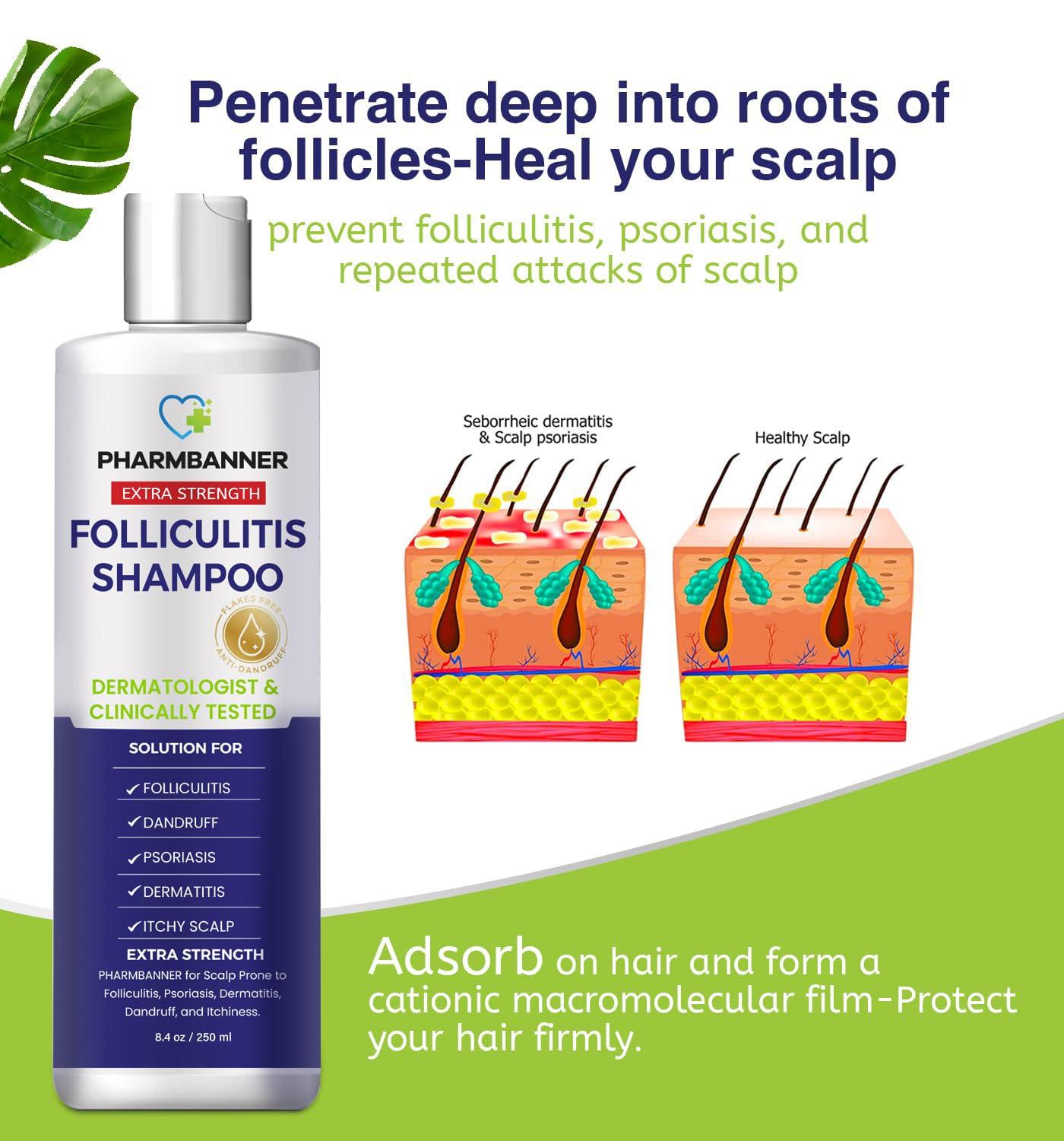 PHARMBANNER Anti-Fungal Shampoo for Folliculitis, Seborrheic Dermatitis, Scalp Psoriasis - Relieves Itchy & Dry Scalp - Image 4