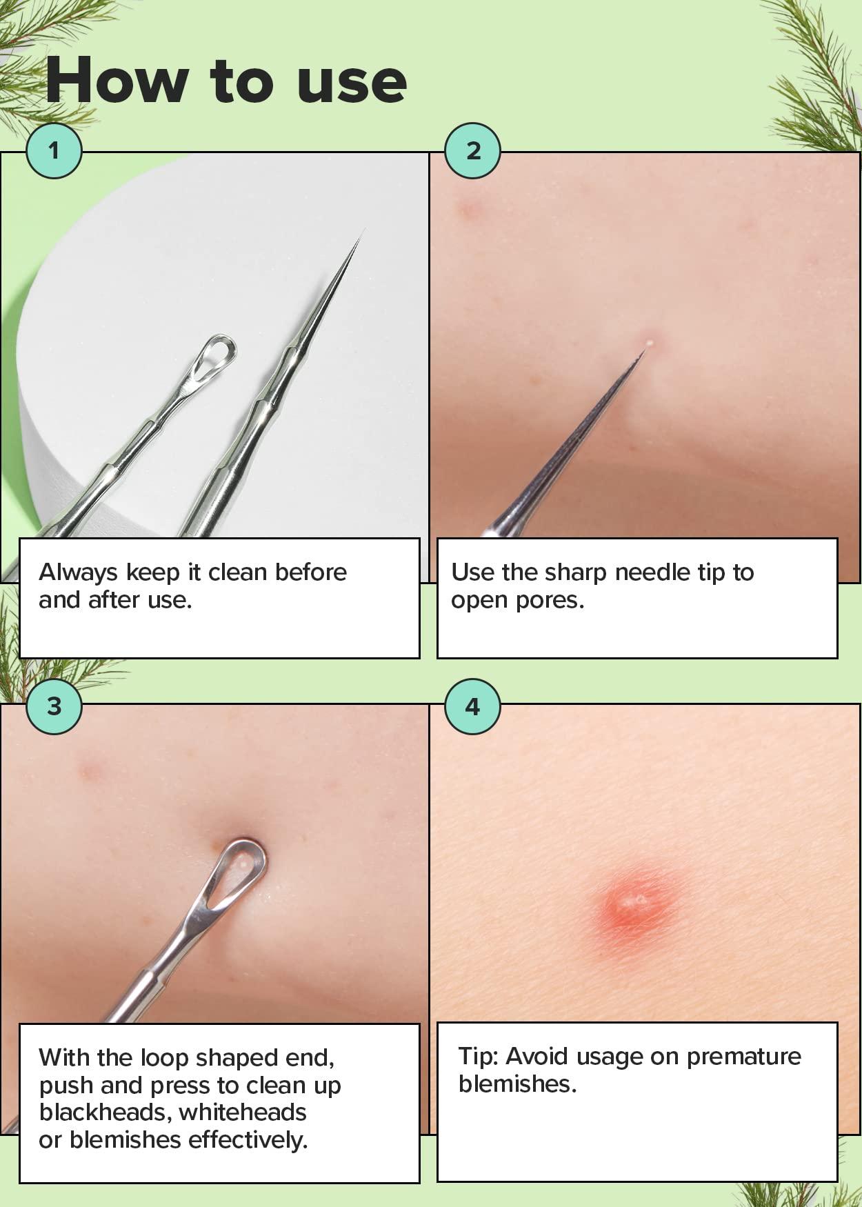 I DEW CARE Dual-Tip Pimple Tool - Proper Popper | Blackhead Remover, Blemish Exfoliating, Professional Acne Squeezer, Comedone Zit Extractor for Women, 2in1 Stainless Steel Lancet, 1ea - Image 5