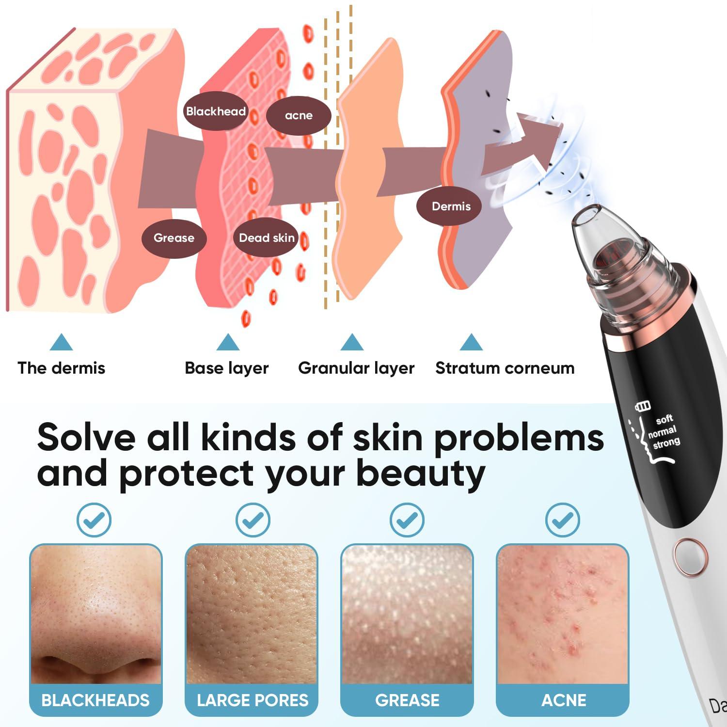 Daweir Blackhead Remover Pore Vacuum - Pimple Extractor Tools Pore Cleaner toolfor Face & Nose - Image 3