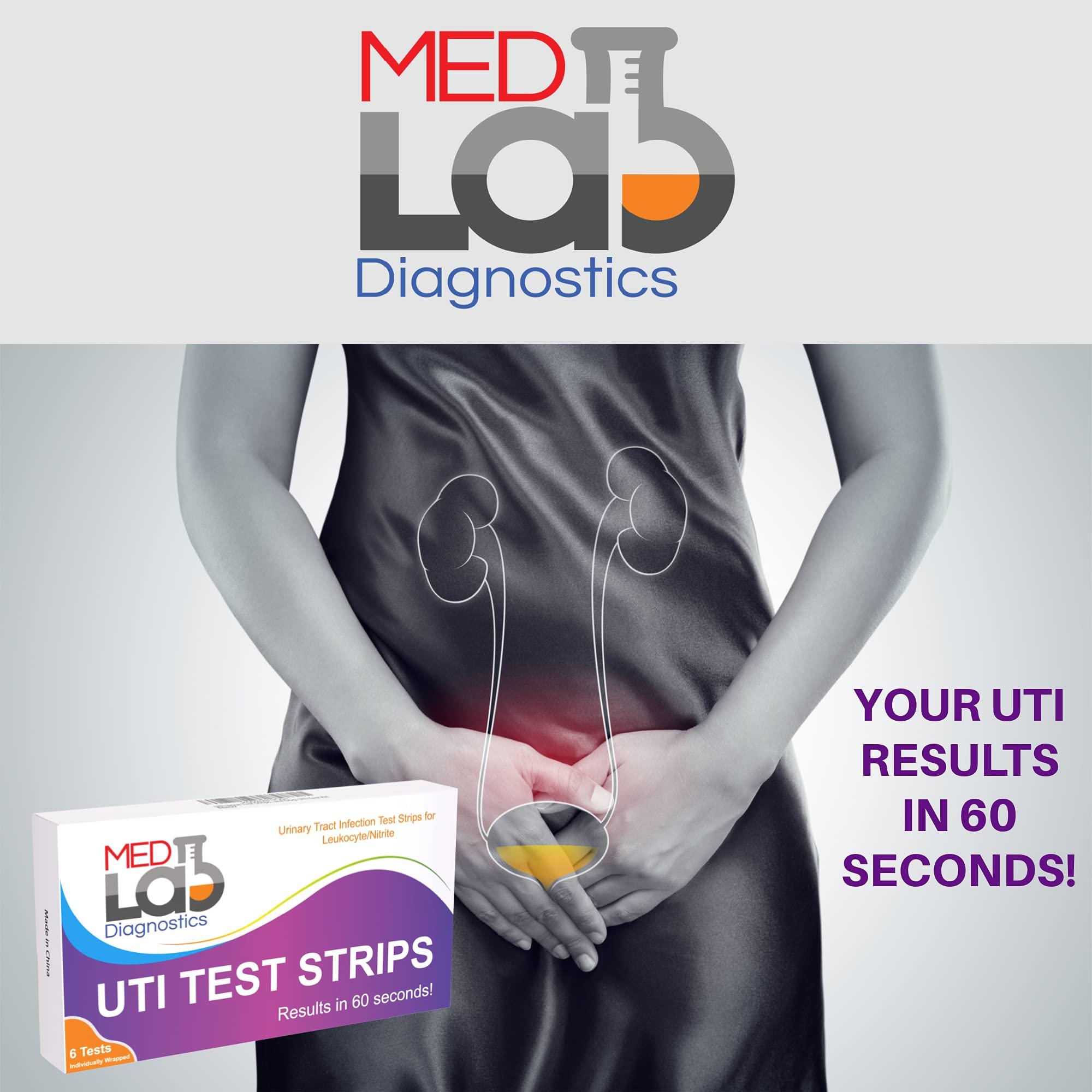 UTI Urine Test Strips(Pack of 6) Individually Wrapped Urinary Tract Infection UTI Test Kit for Women, Men, Kids Cats and Dogs - Image 7