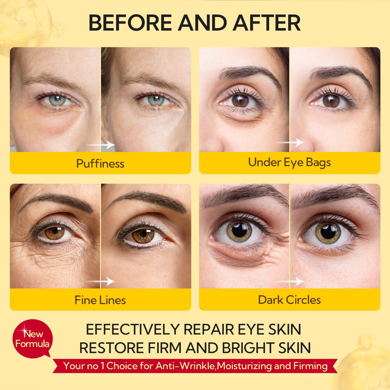 LANBENA Under Eye Patches (30 Pairs) - Gold Under Eye Mask Retinol & Collagen, Under Eye Mask for Face Care, Eye Masks for Dark Circles and Puffiness, Under Eye Masks for Beauty & Personal Care - Image 7