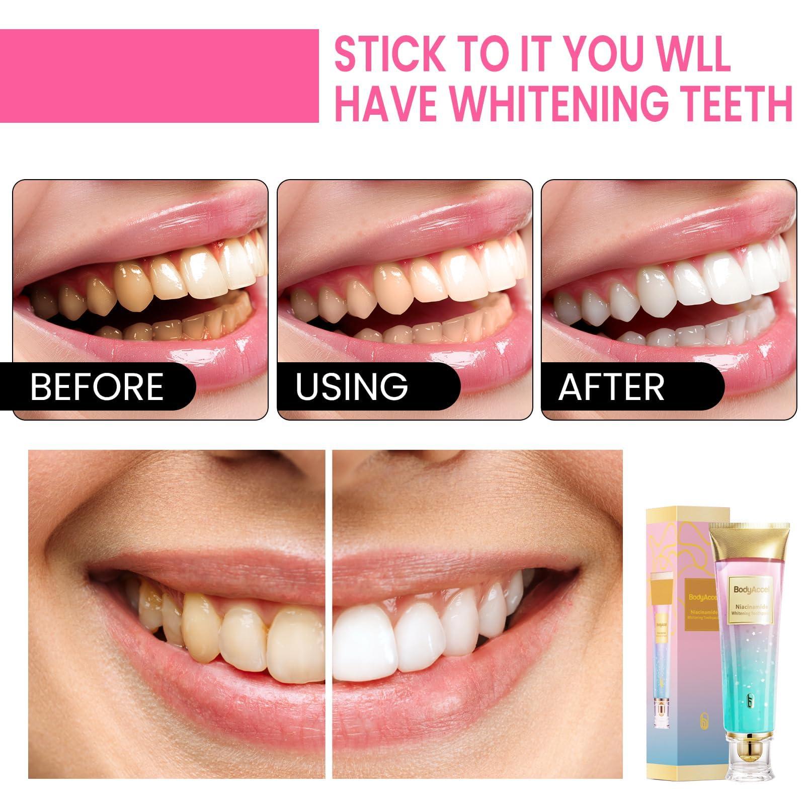 Niacinamide Whitening Toothpaste – BodyAccel Natural Whitening Toothpaste with Niacinamide, Gentle Formula for Brighter Teeth & Fresh Breath, 2-Pack (2) - Image 5