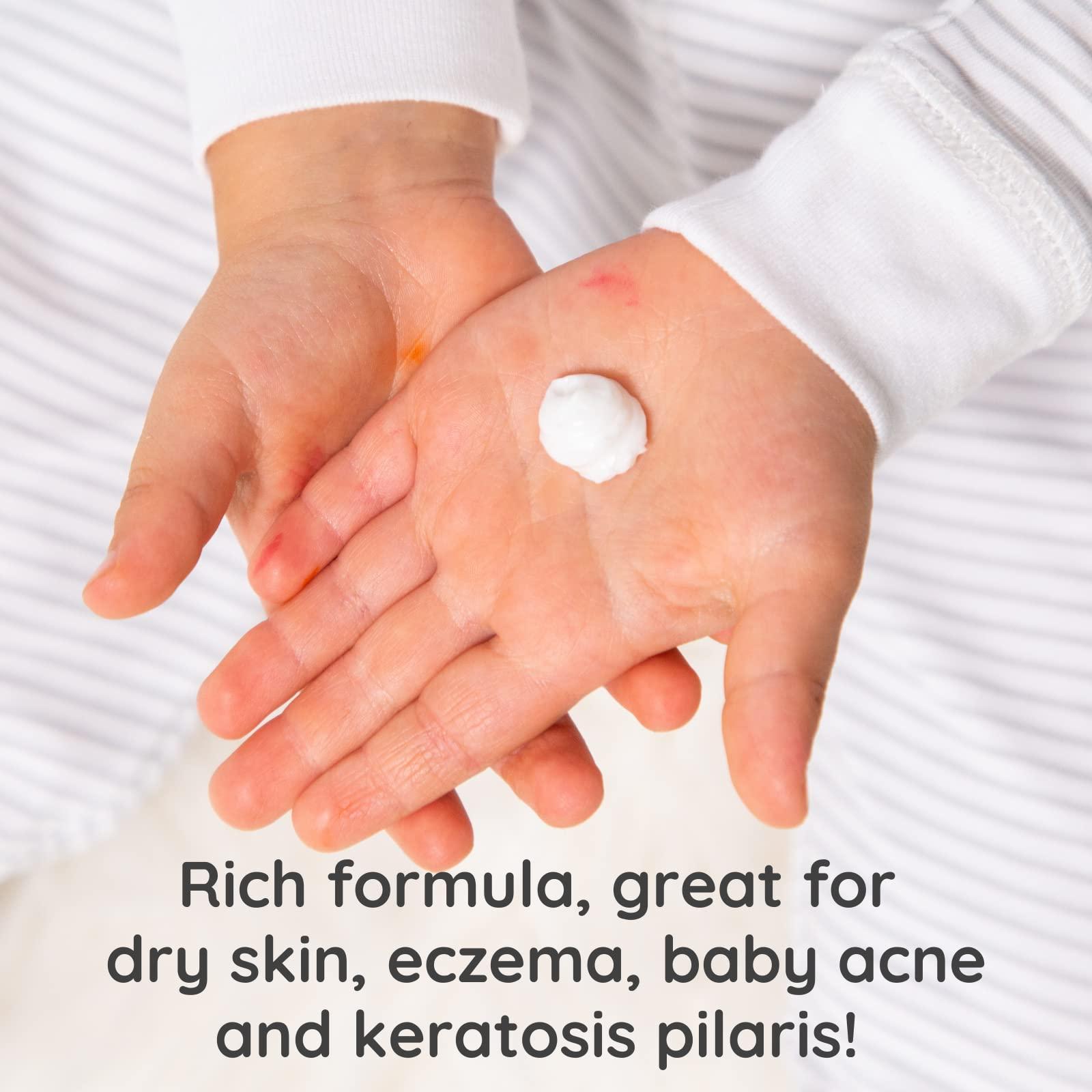 Bubbsi Whipped Coconut Oil Baby Lotion for Eczema, Dry Skin, Baby Acne, KP | Organic Coconut Oil, Shea Butter, Vitamin E | Light, Natural Scent | EU Compliant, Vegan (Refillable, 8oz) - Image 3