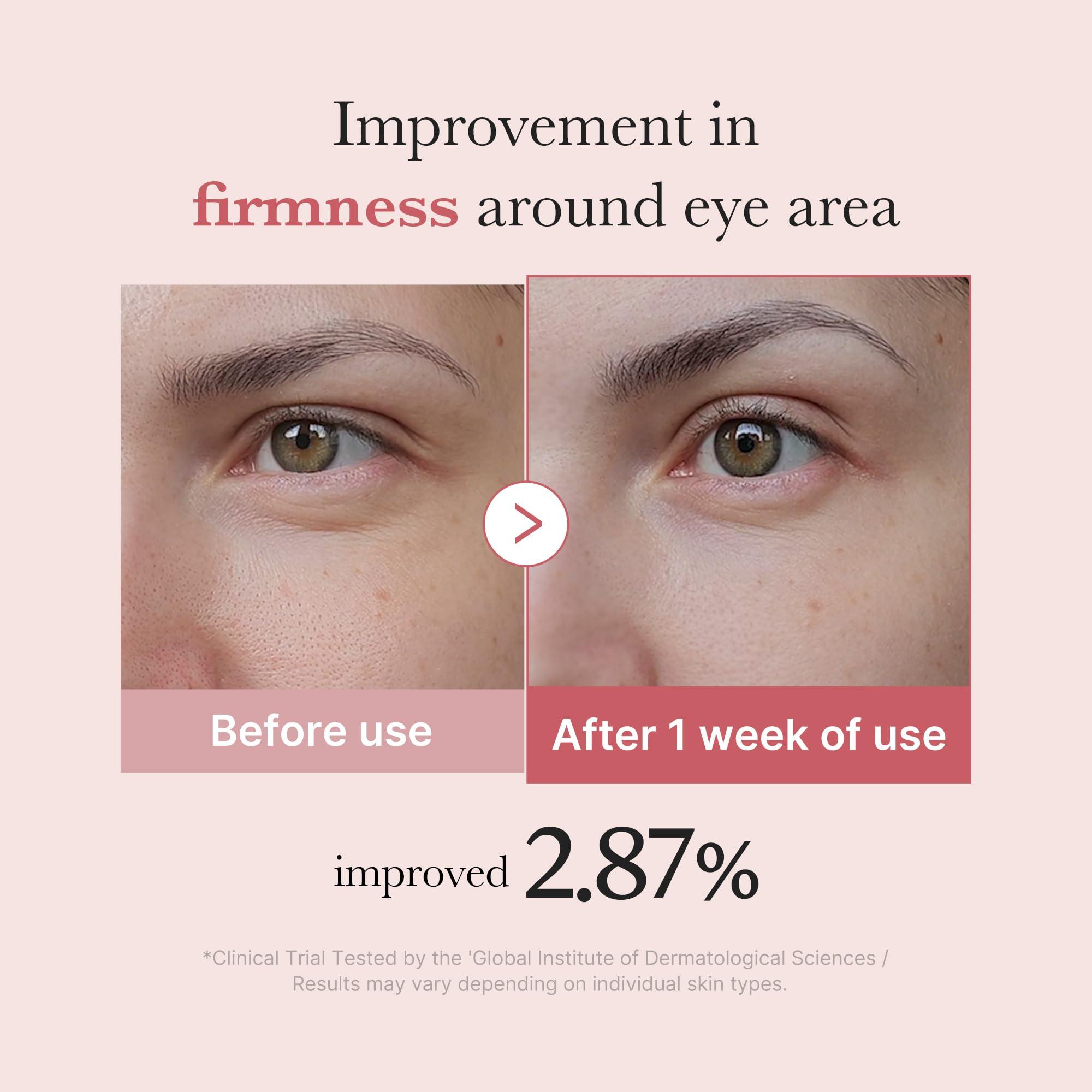 medicube Salmon DNA PDRN Pink Peptide Eye Serum with Niacinamide and 99% Purity Retinol for Fine Lines, Uneven Skin Tone, Korean Skin Care 1.01fl.oz - Image 4