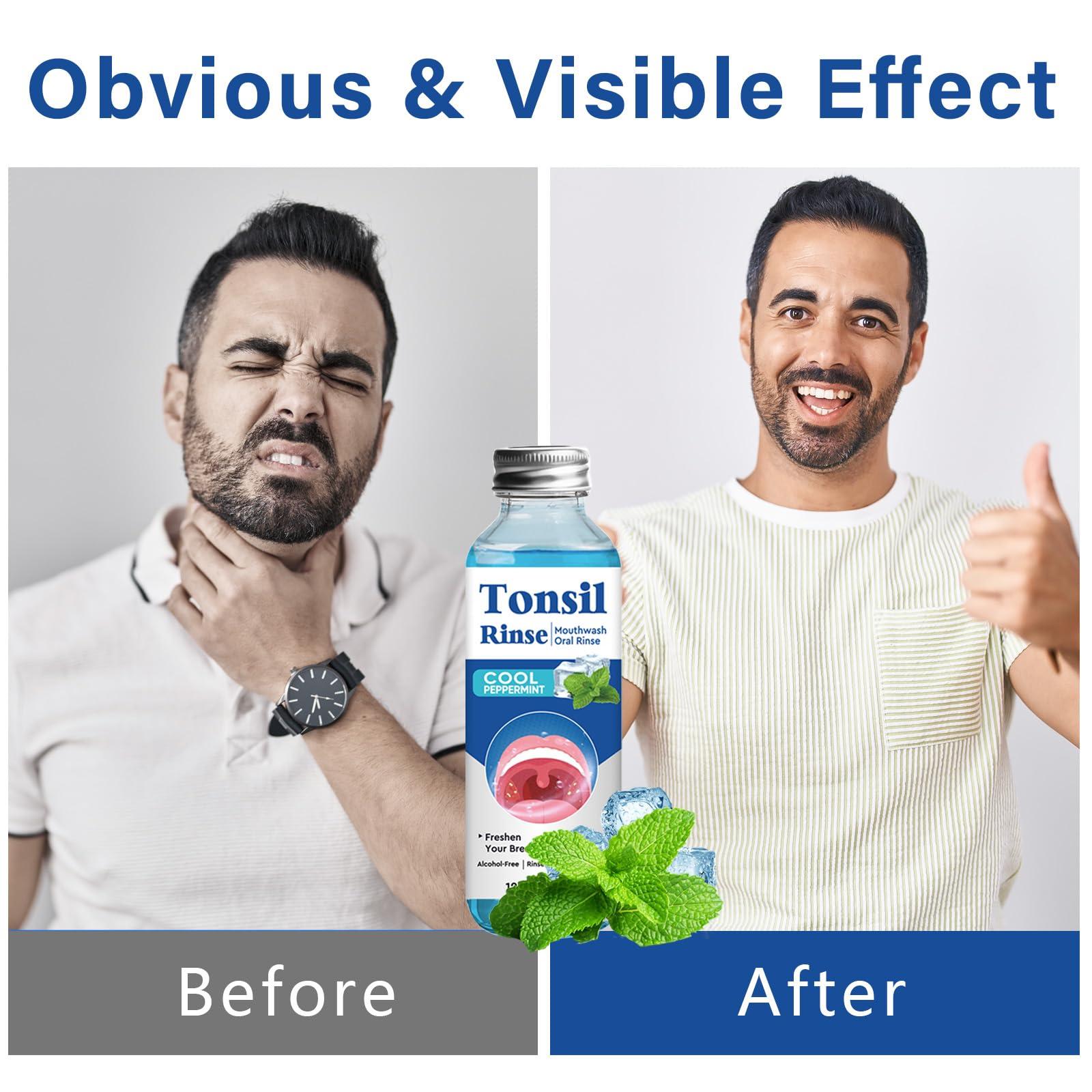 Tonsil Stone Remover, Nature Tonsil Stone Mouthwash or Oral Rinse Liquid to Remove Bad Breath, Soothe Dry Mouth & Fresh Breath, Tonsil Stone Removal Liquid, 4Fl Oz - Image 5