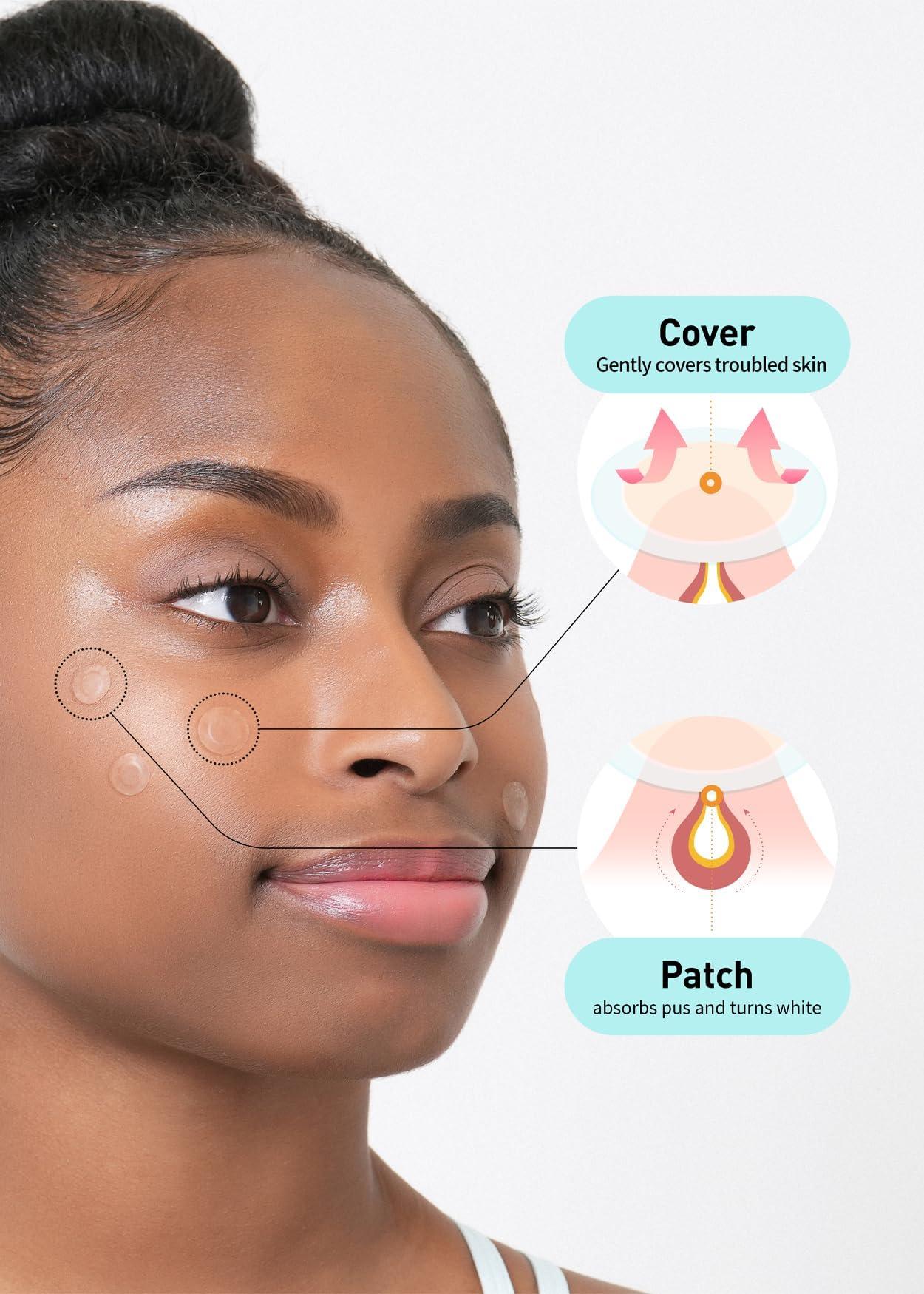 OLIVE YOUNG Care Plus Spot Patch | Hydrocolloid Acne Korean Spot Patch to Cover Zits, Pimples and Blemishes, for Troubled Skin and Face (Hydrocolloid, 102 Count (Pack of 1)) - Image 4