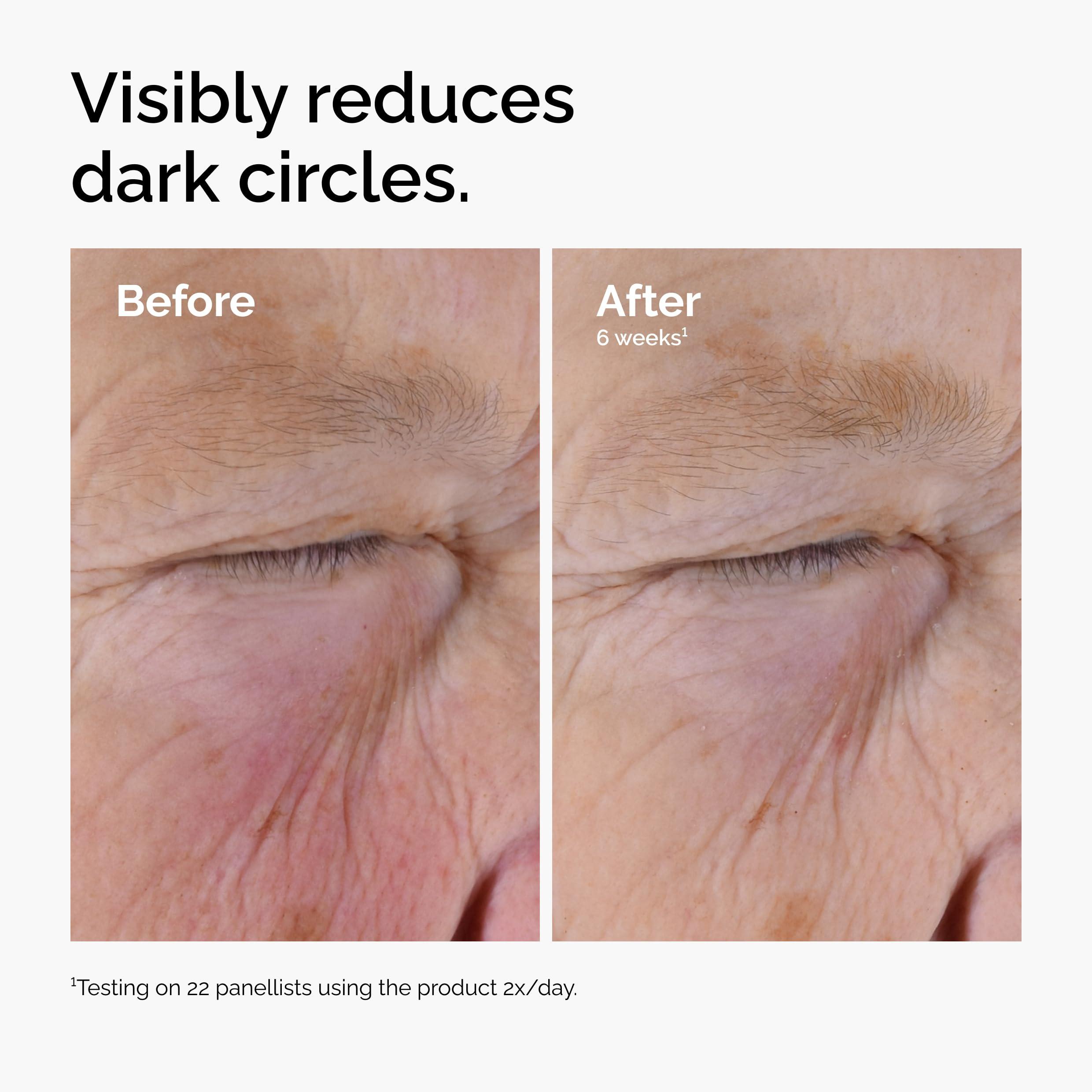 The Ordinary Caffeine Solution 5% + EGCG, Depuffing Eye Serum for Dark Circles and Tired Eyes - Image 5